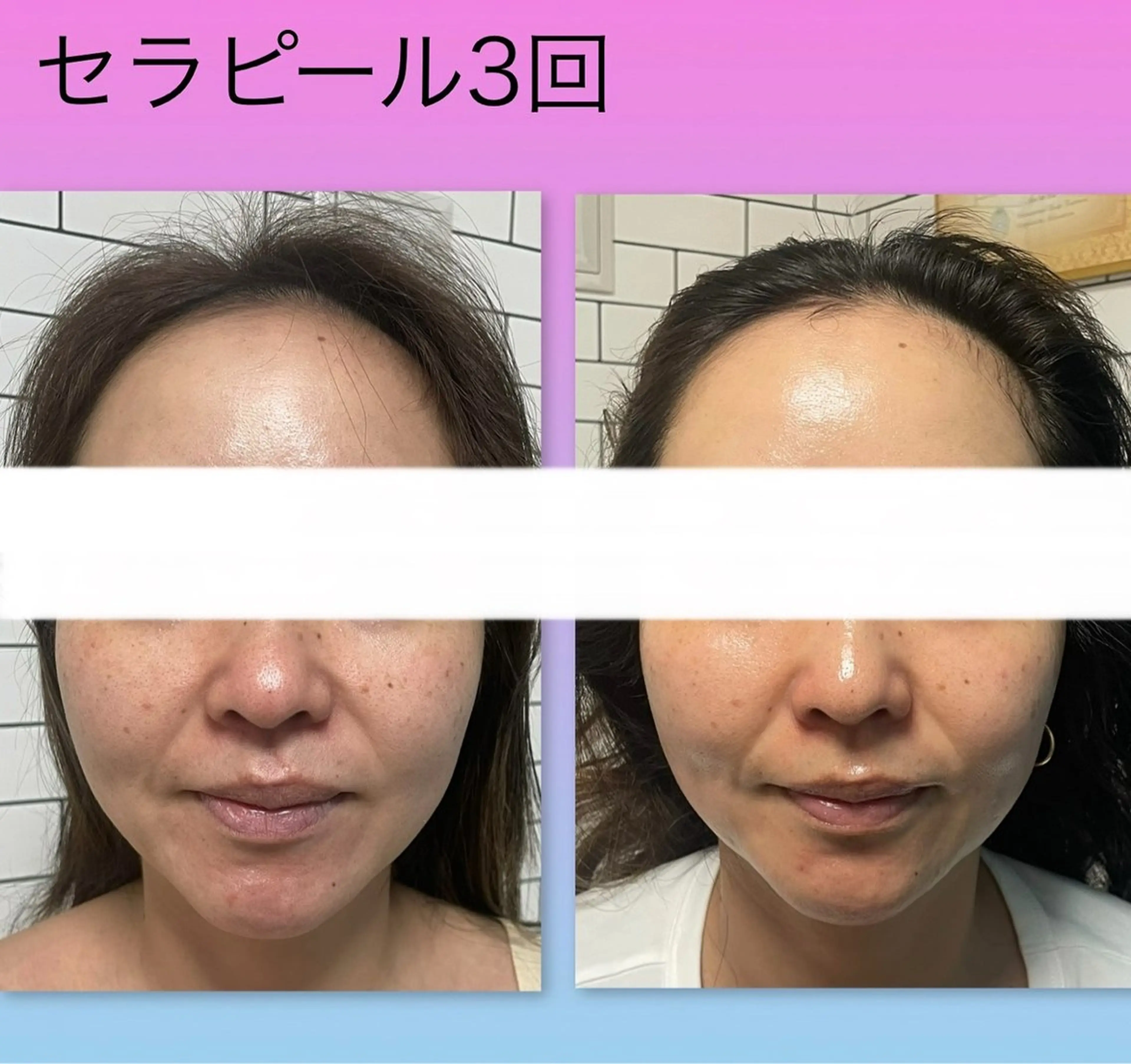 エステ Ageing salon Be.所属・エイジングサロンビー EMIのエステ・リラクイメージ