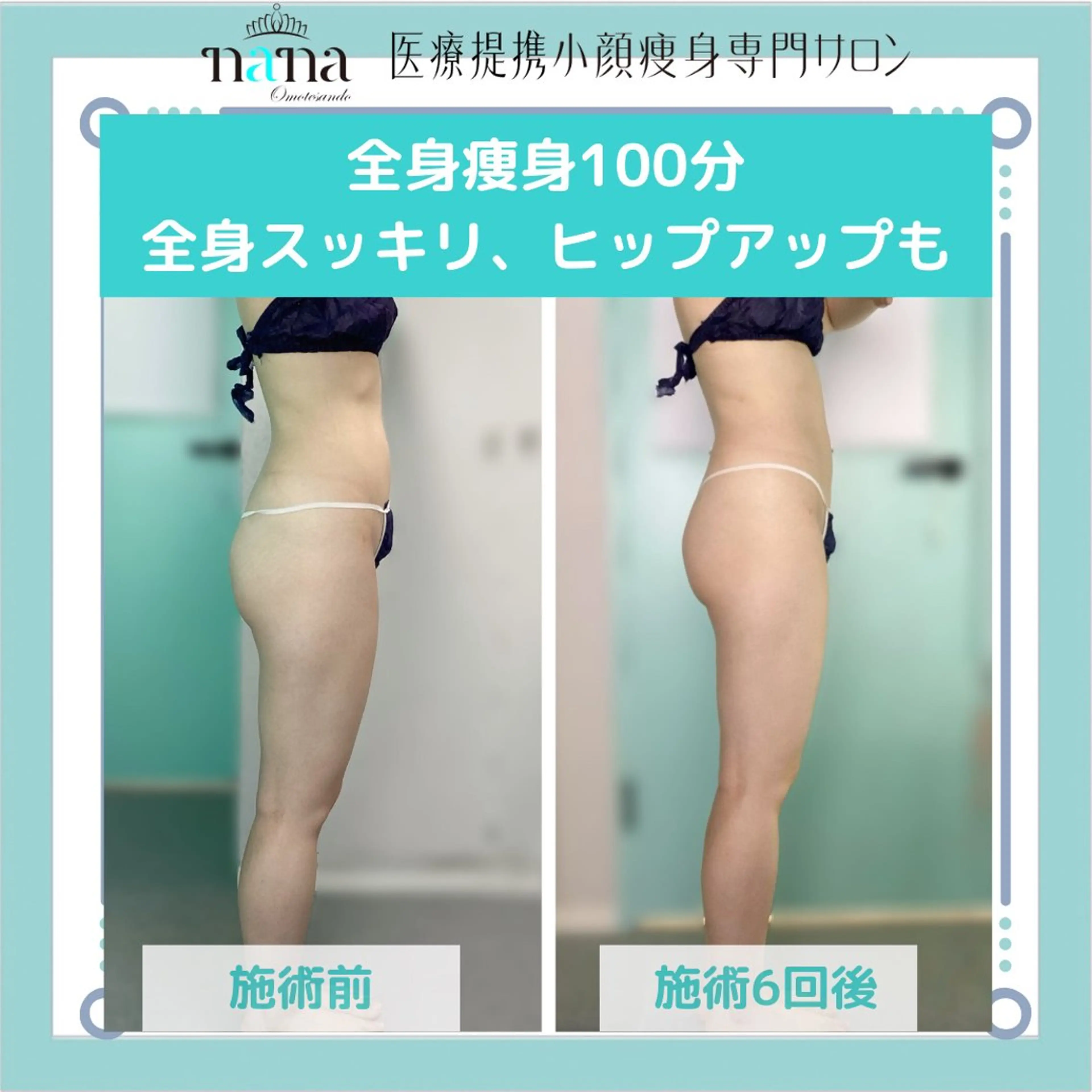 小顔痩身インディバ Nana表参道のエステ・リラクイメージ