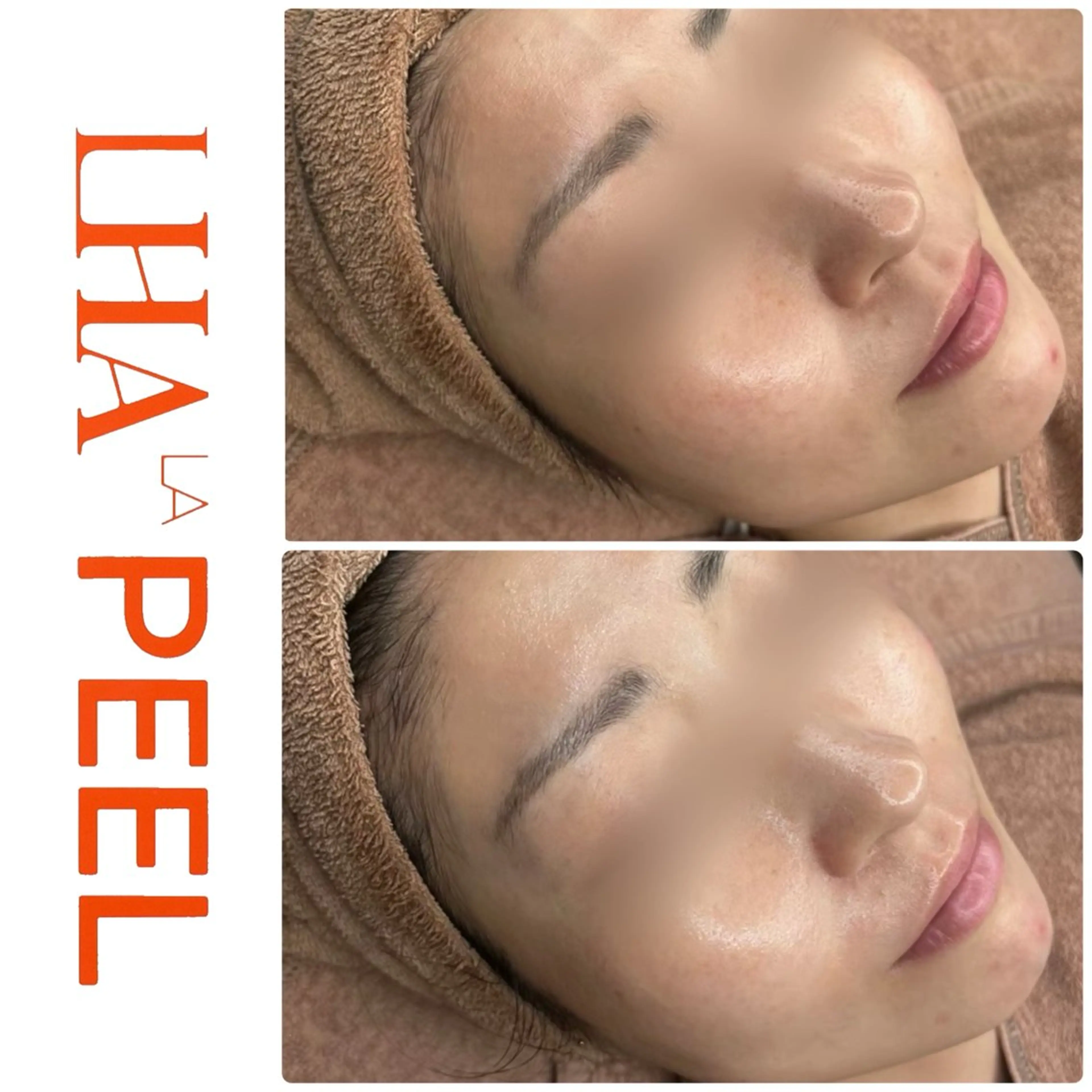 ハーブピーリング専門 BIOEL横浜のエステ・リラクイメージ