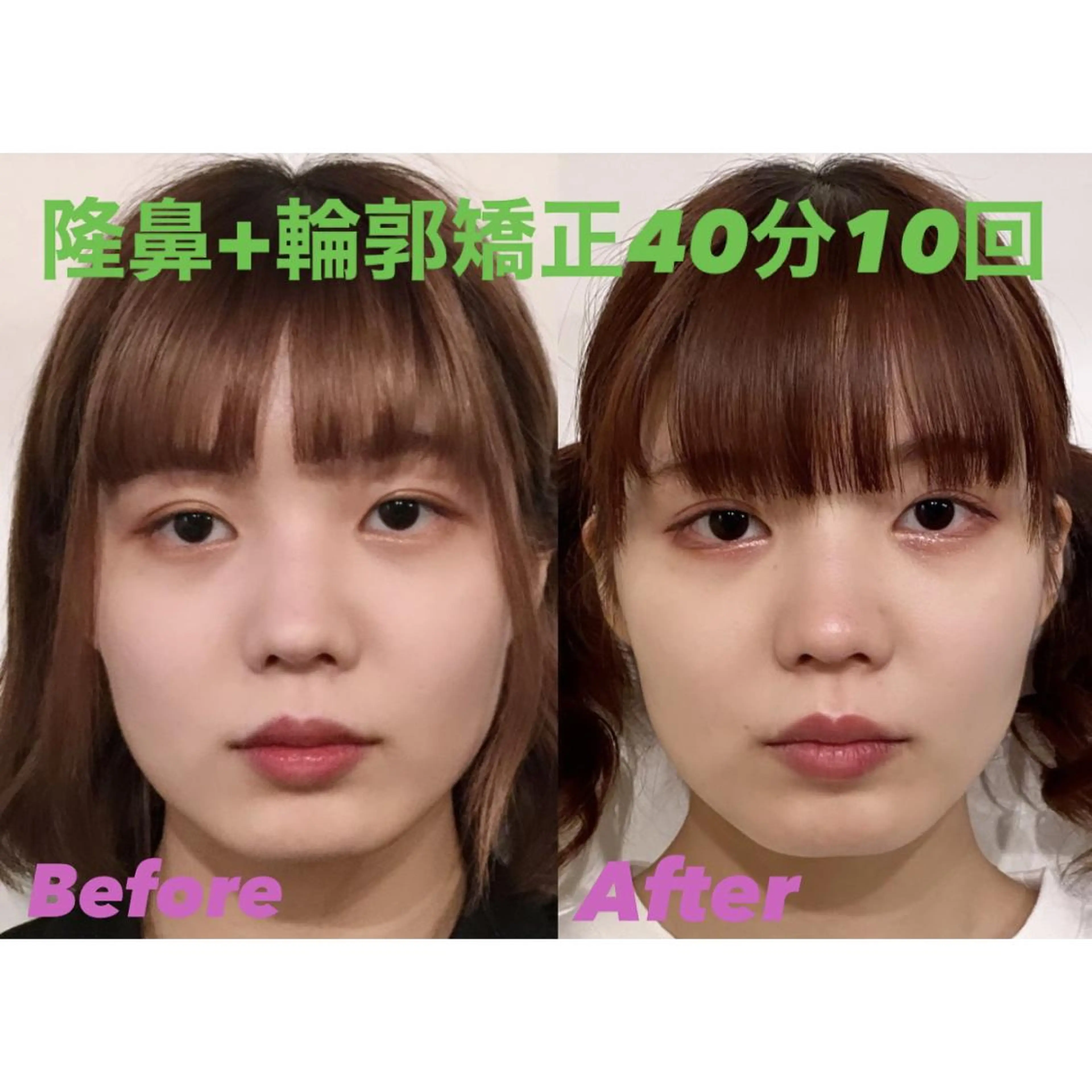 隆鼻矯正専門店ラプリ 佐藤のエステ・リラクイメージ