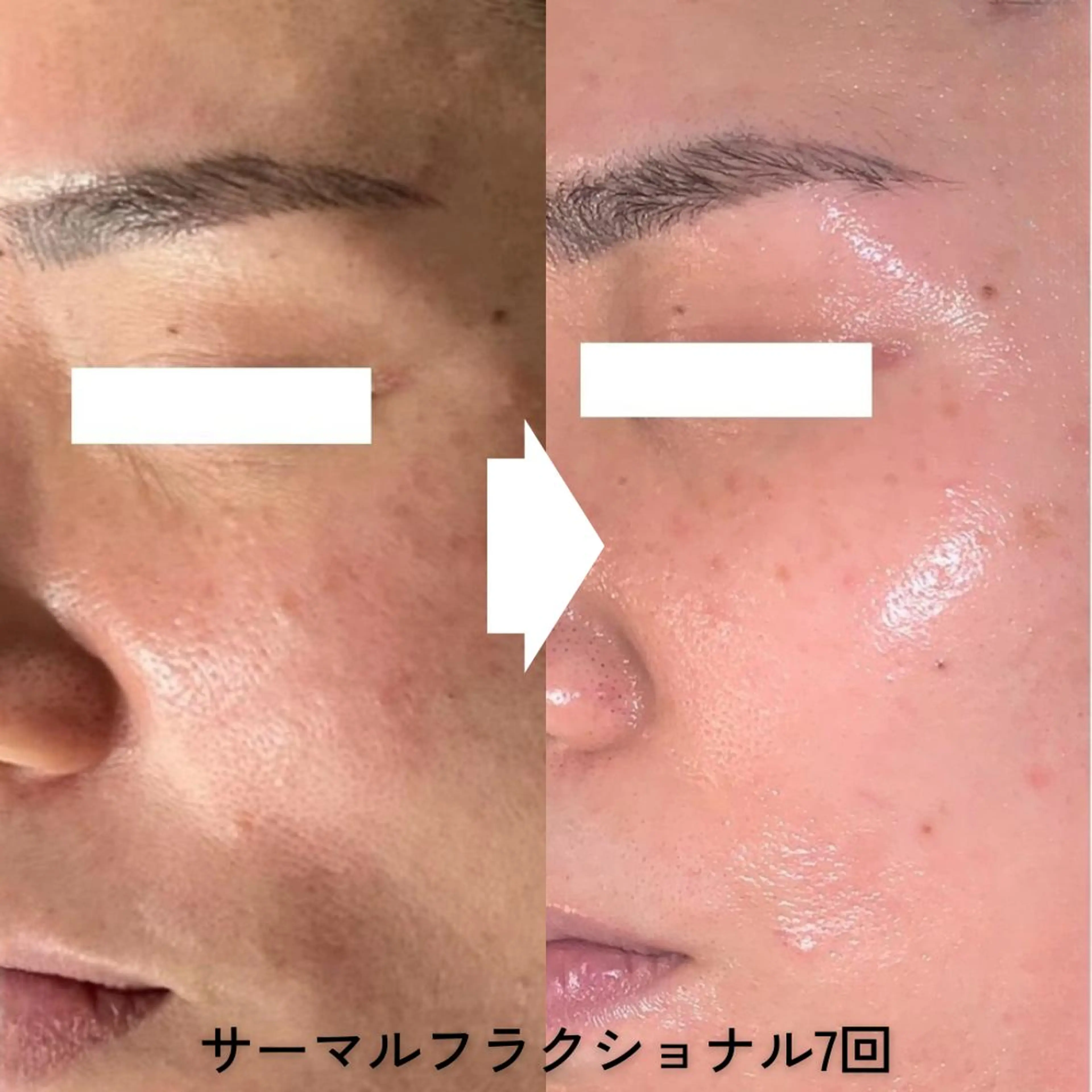 B-st. セルフエステ 下北沢のエステ・リラクイメージ