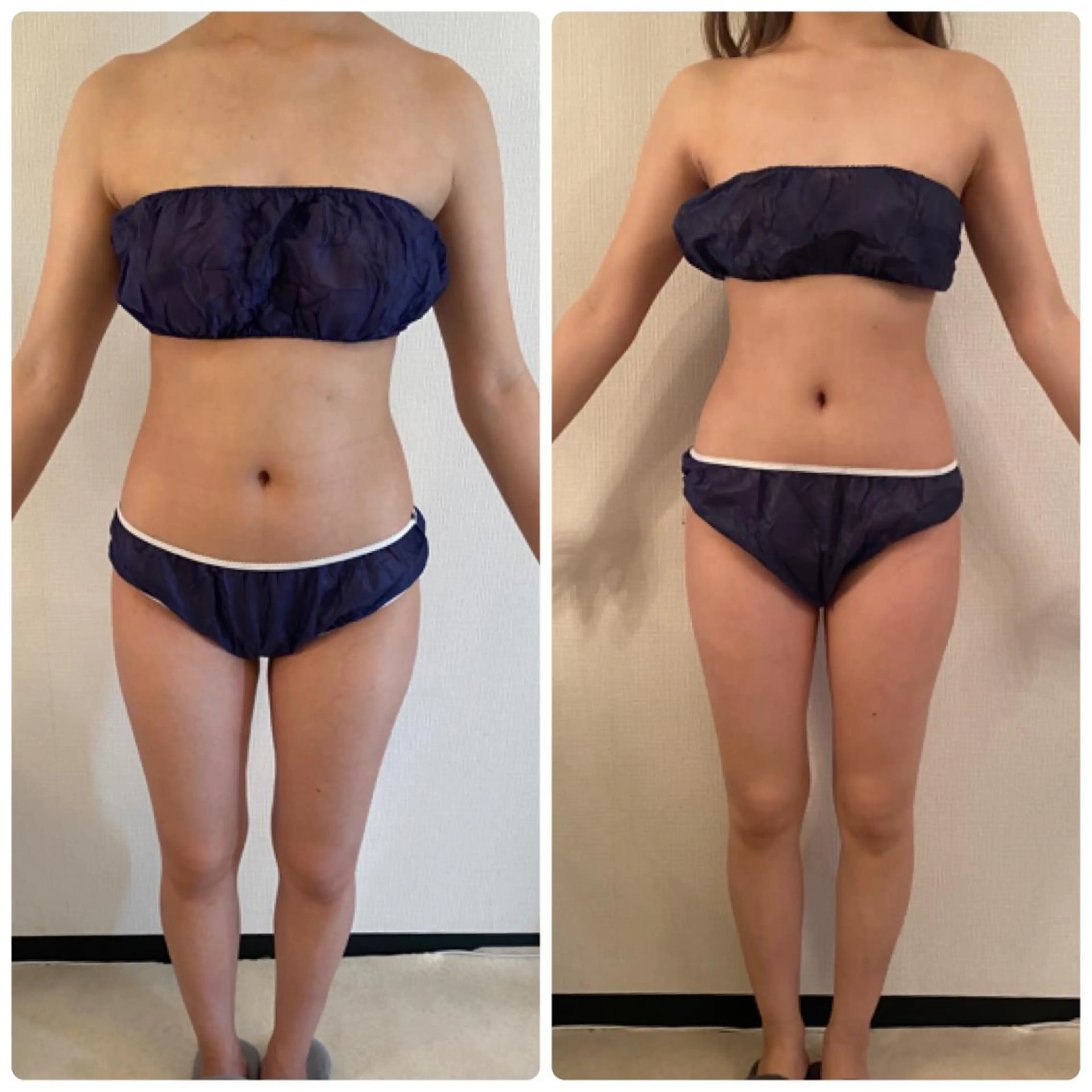 FLEUR大阪・整体 ・ハイフ・痩身・小顔のエステ・リラクイメージ