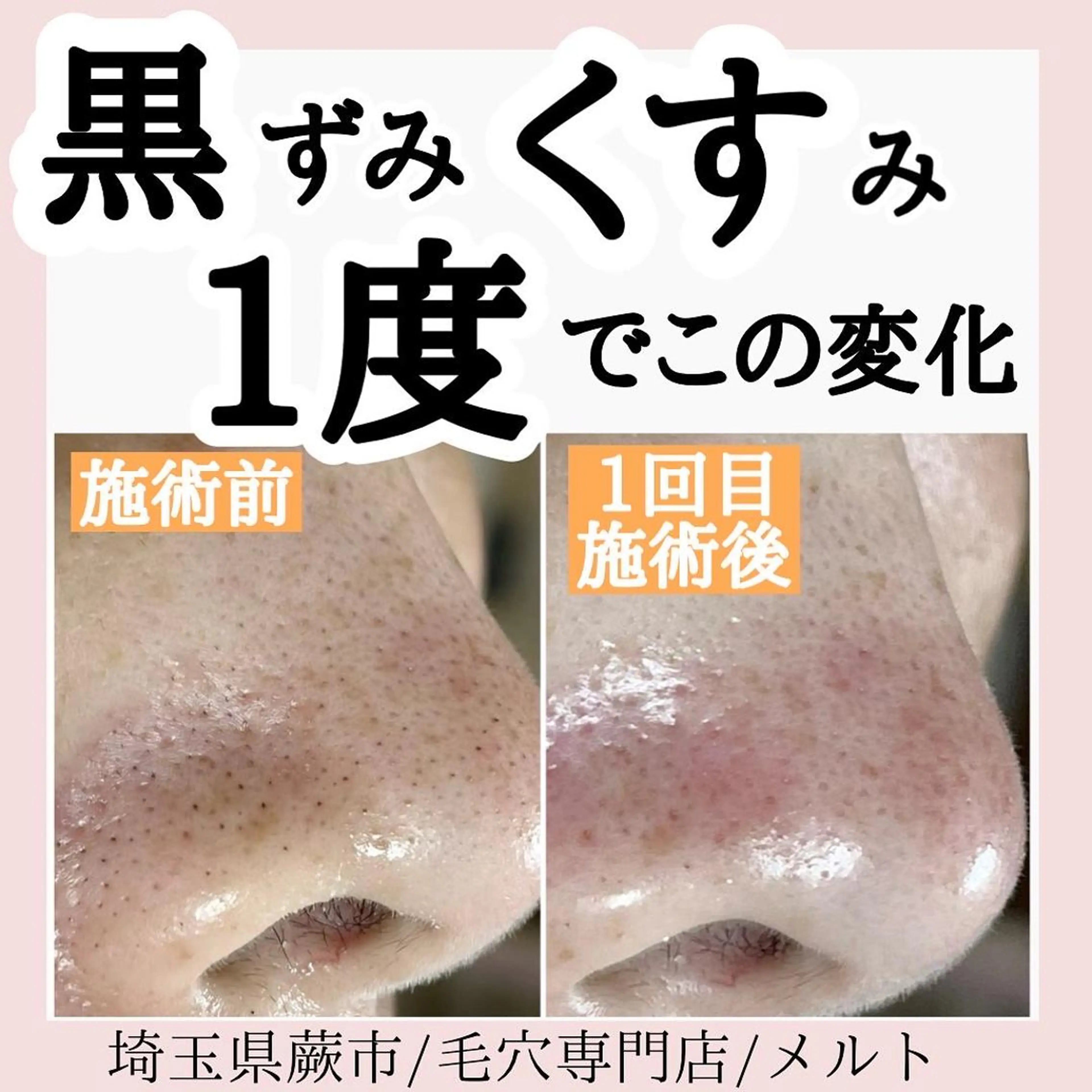 エステ melt まみのマツエク・マツパデザイン