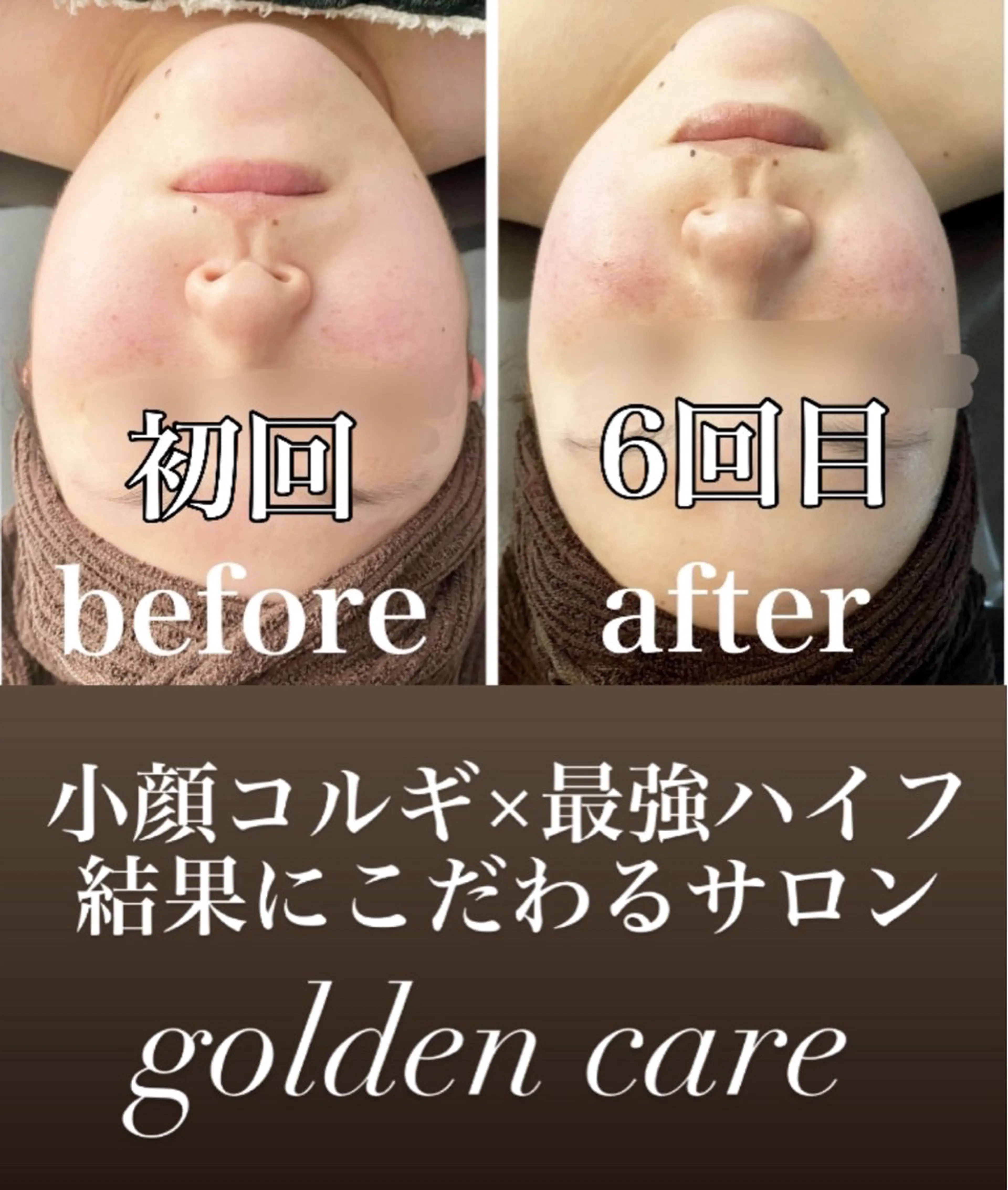 エステ リラク ■超絶小顔＆肌管理室■所属・🦋整形級の究極美顔 本格韓国式小顔🦋のエステ・リラクイメージ
