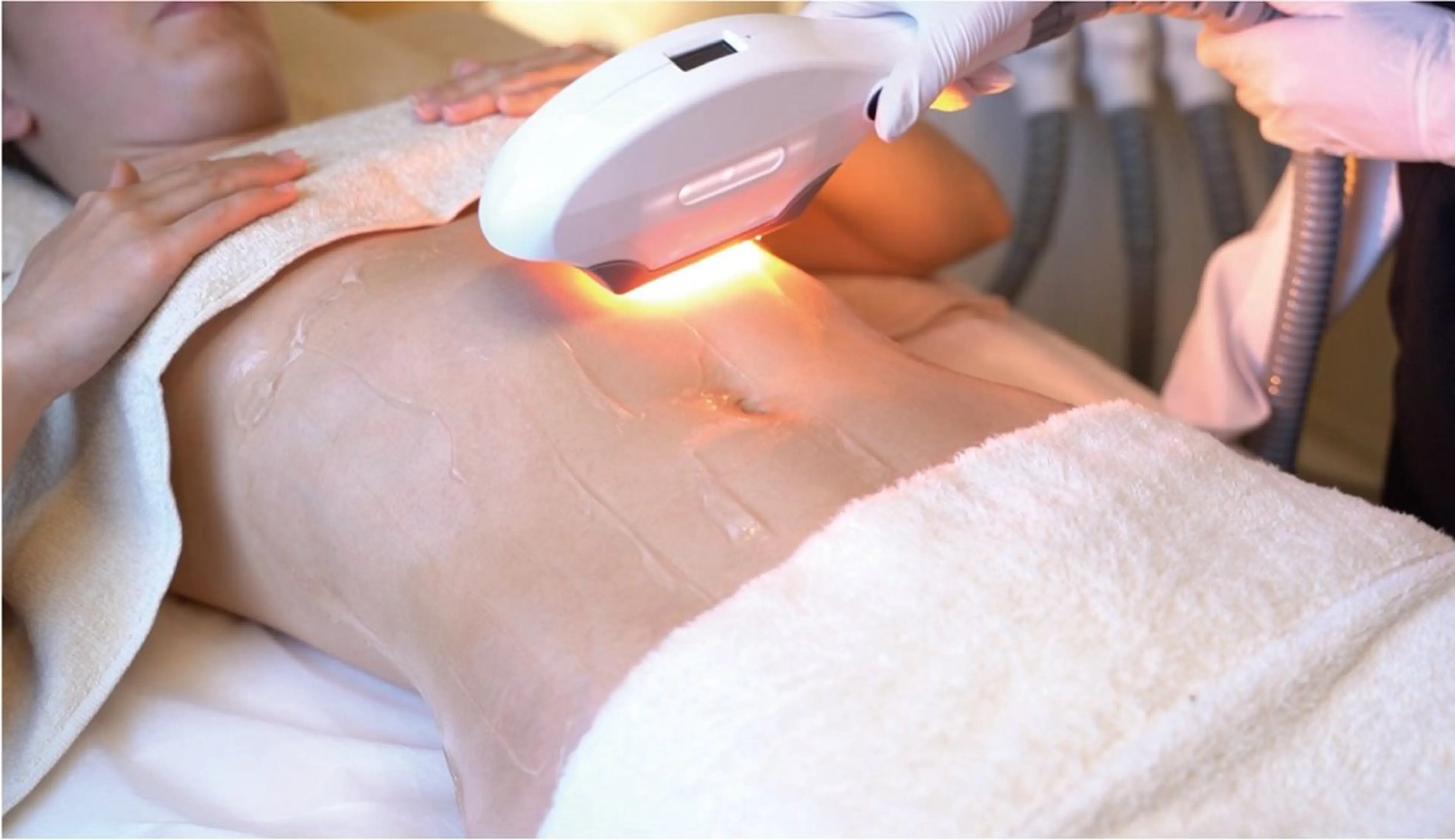 全身脱毛【お顔・VIO付き】女性限定の写真