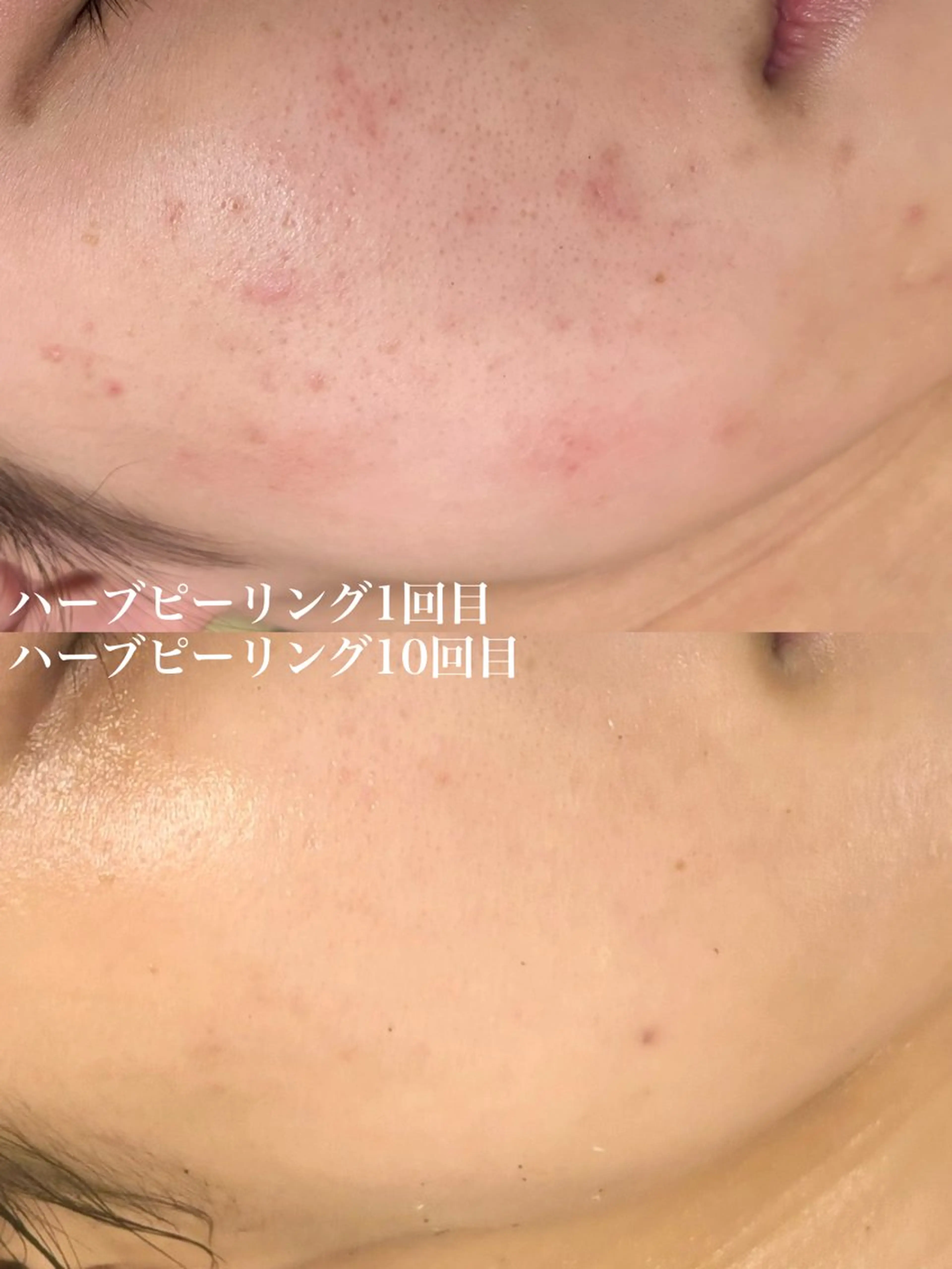 WHITE AQUA 北千住店のエステ・リラクイメージ