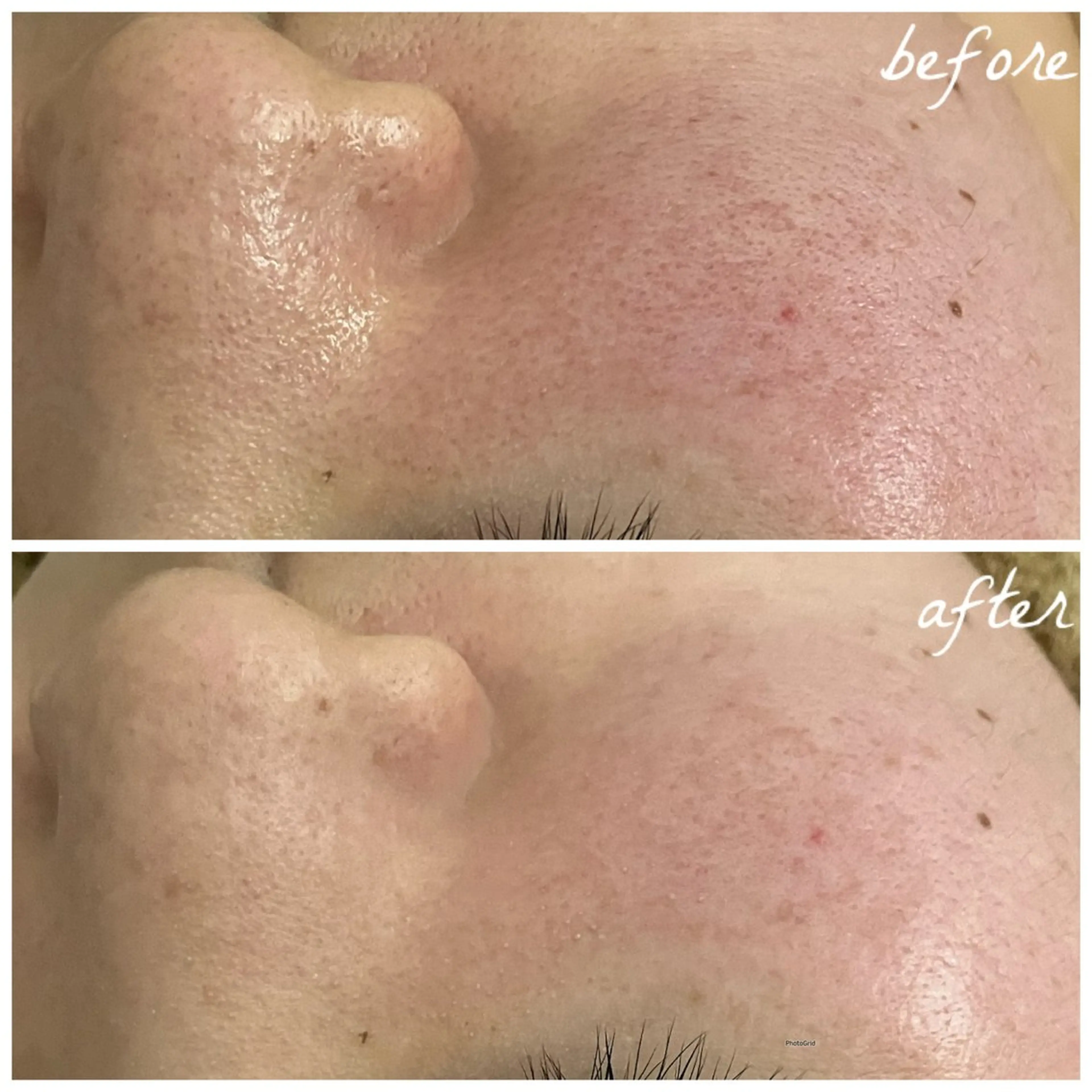 メンズ エステ メナード岐阜茜部 杉浦のエステ・リラクイメージ