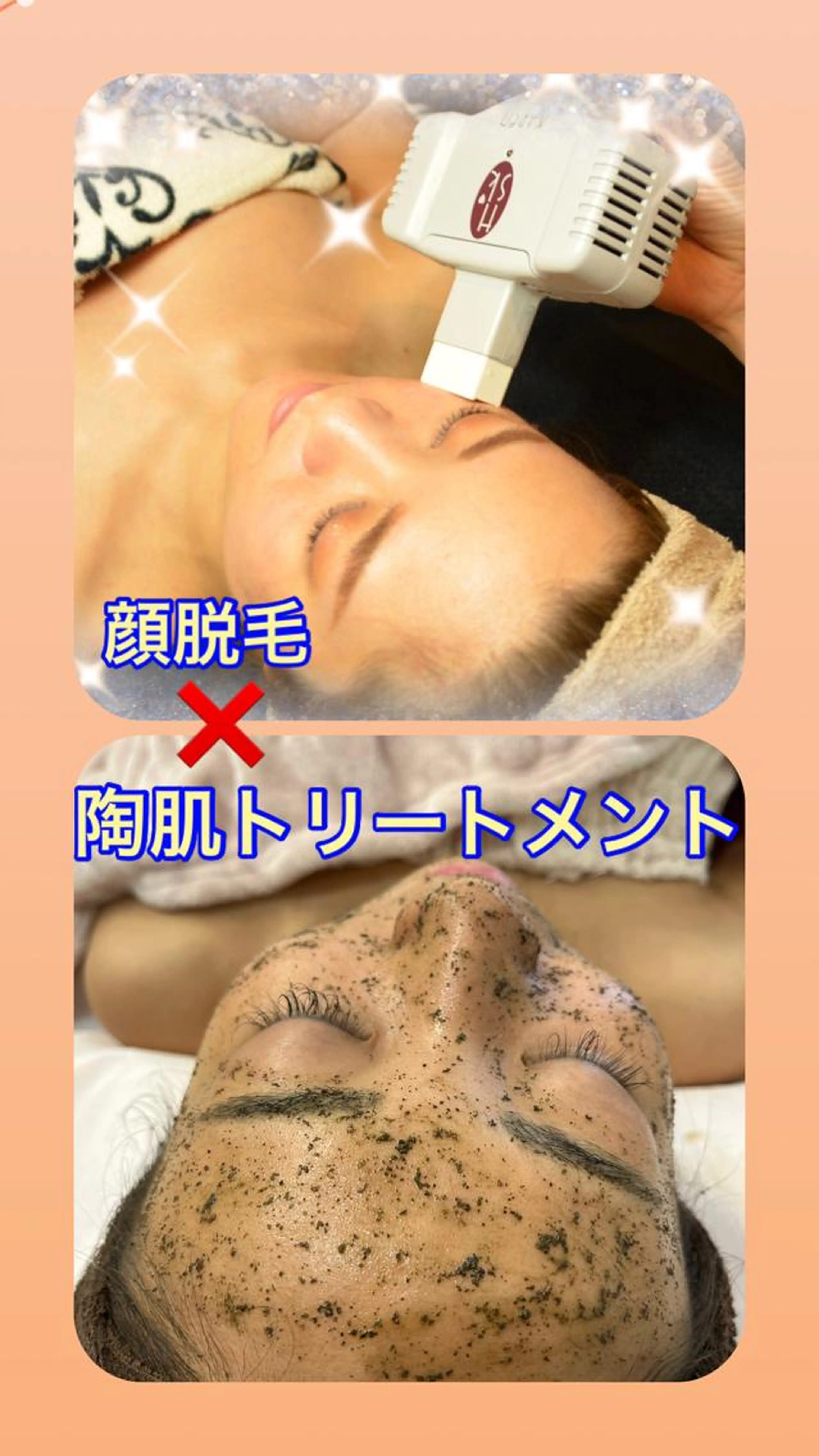お顔脱毛✖︎陶肌トリートメントの写真