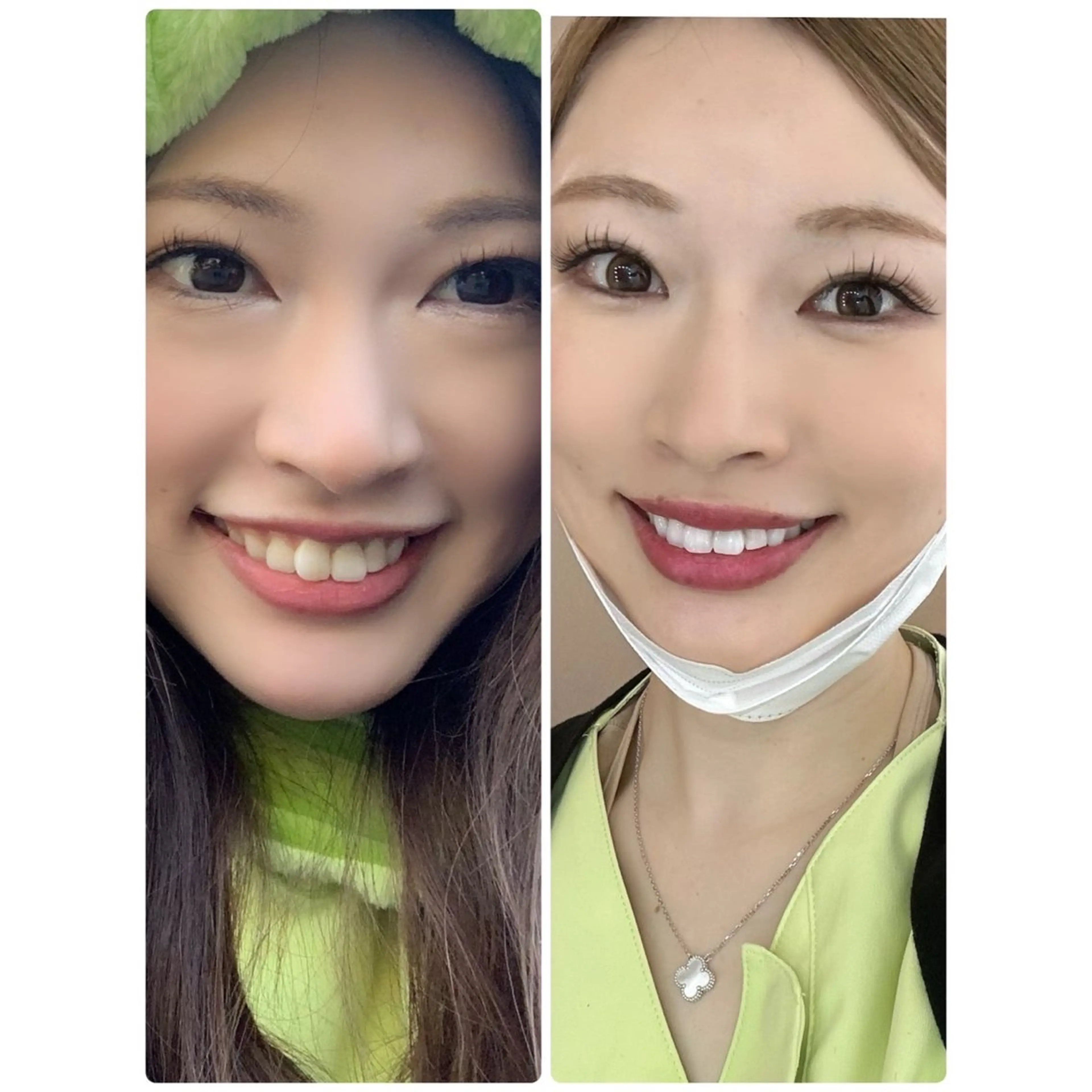 エステ プラチナムビューティー柏所属・【歯科連携】柏ホワイ トニング専門店のその他イメージ