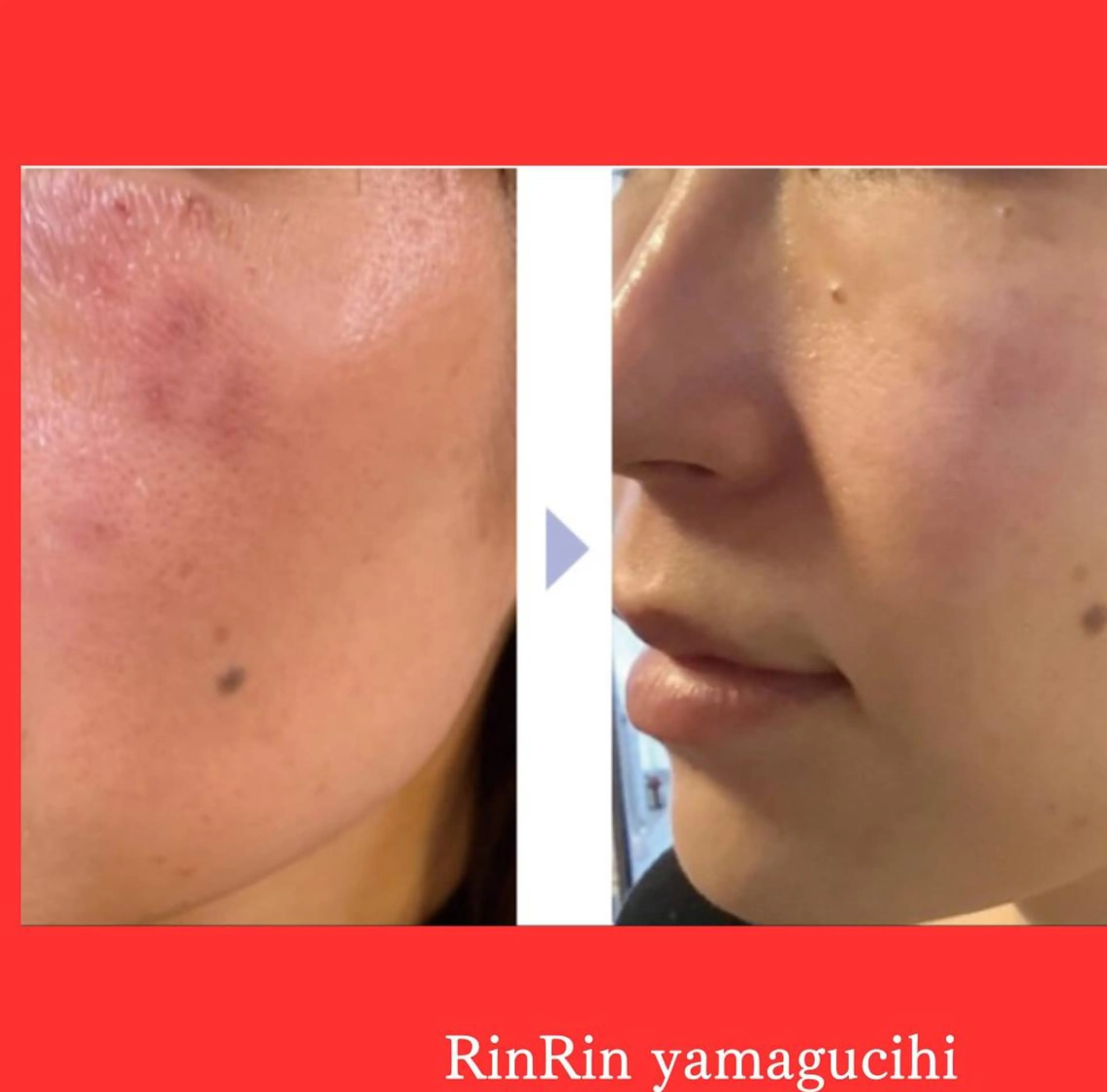 RinRin 山口店のエステ・リラクイメージ