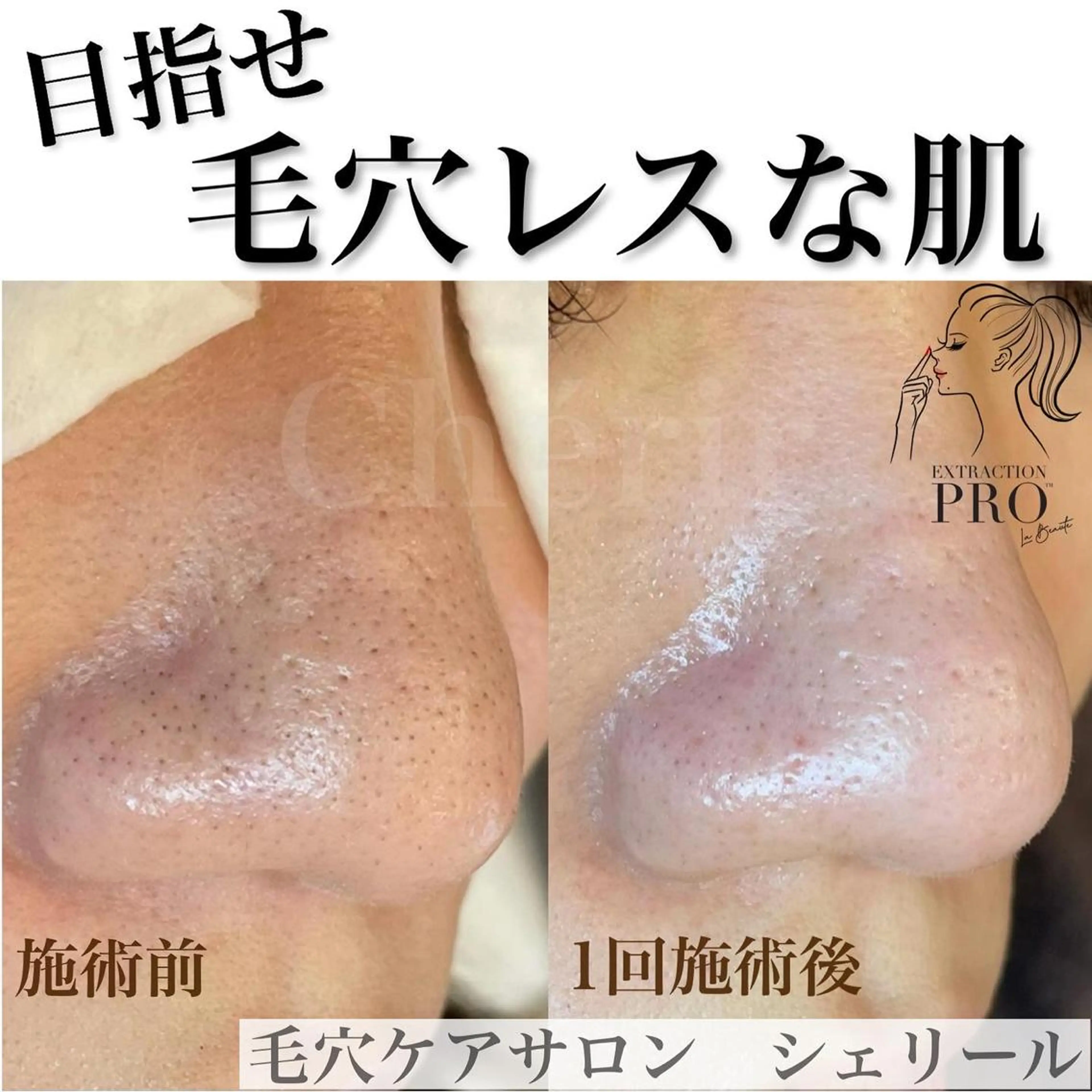 シェリール✳︎ Erinaのマツエク・マツパデザイン