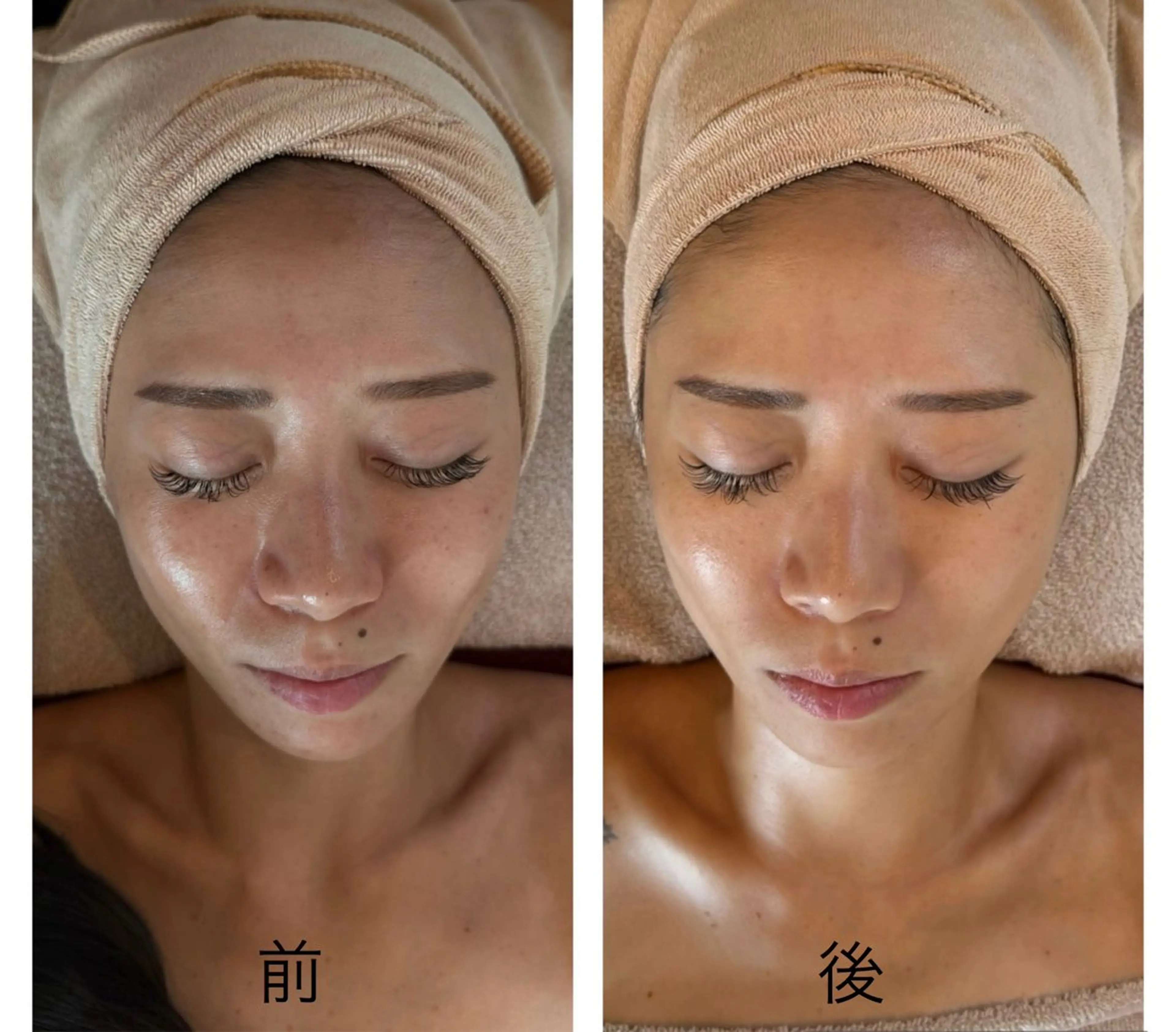 エステ MiEL  total beaty salon所属・肌質改善サロン ナツコのエステ・リラクイメージ