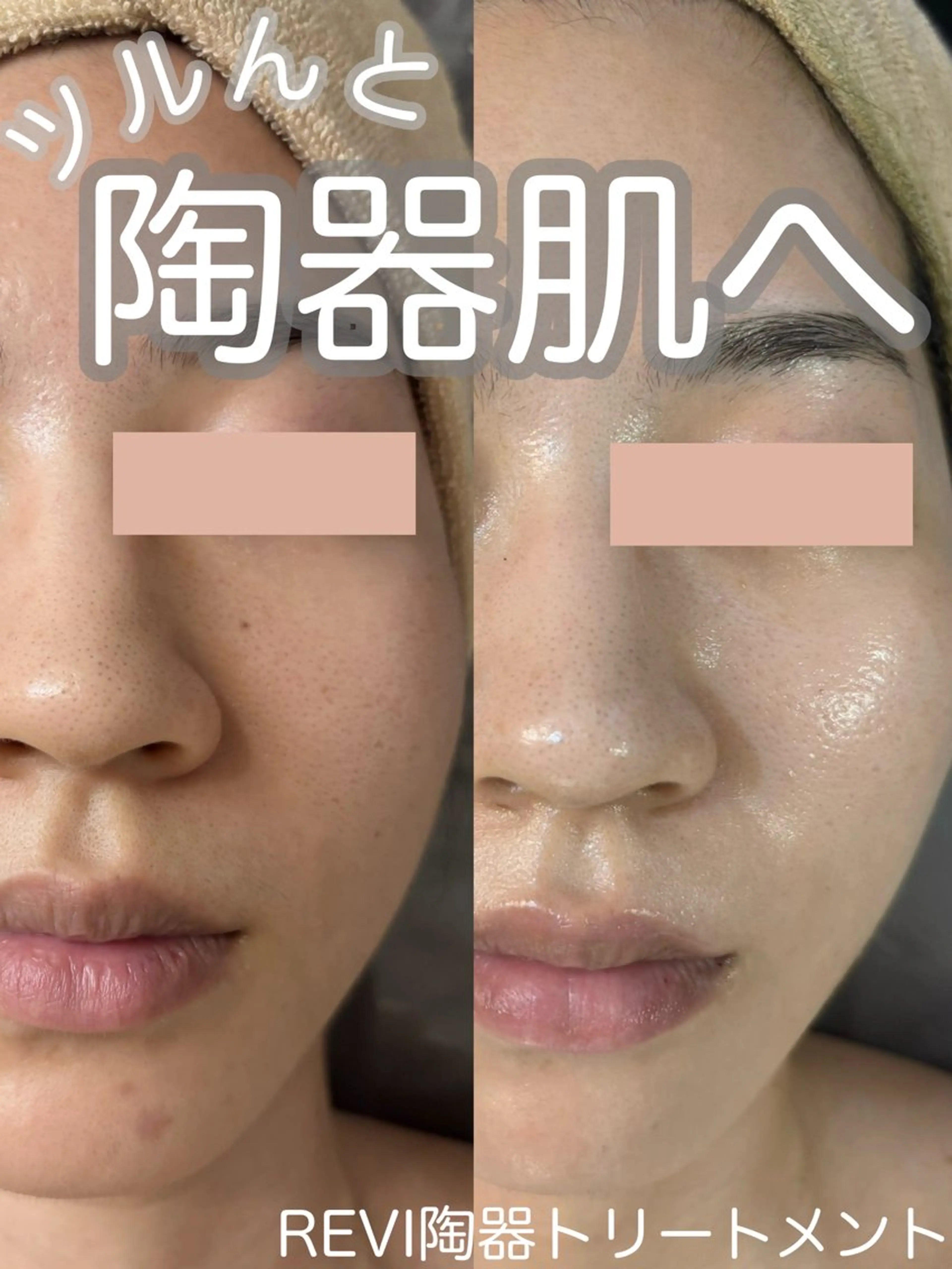 エステ WHITE AQUA 北千住店のエステ・リラクイメージ