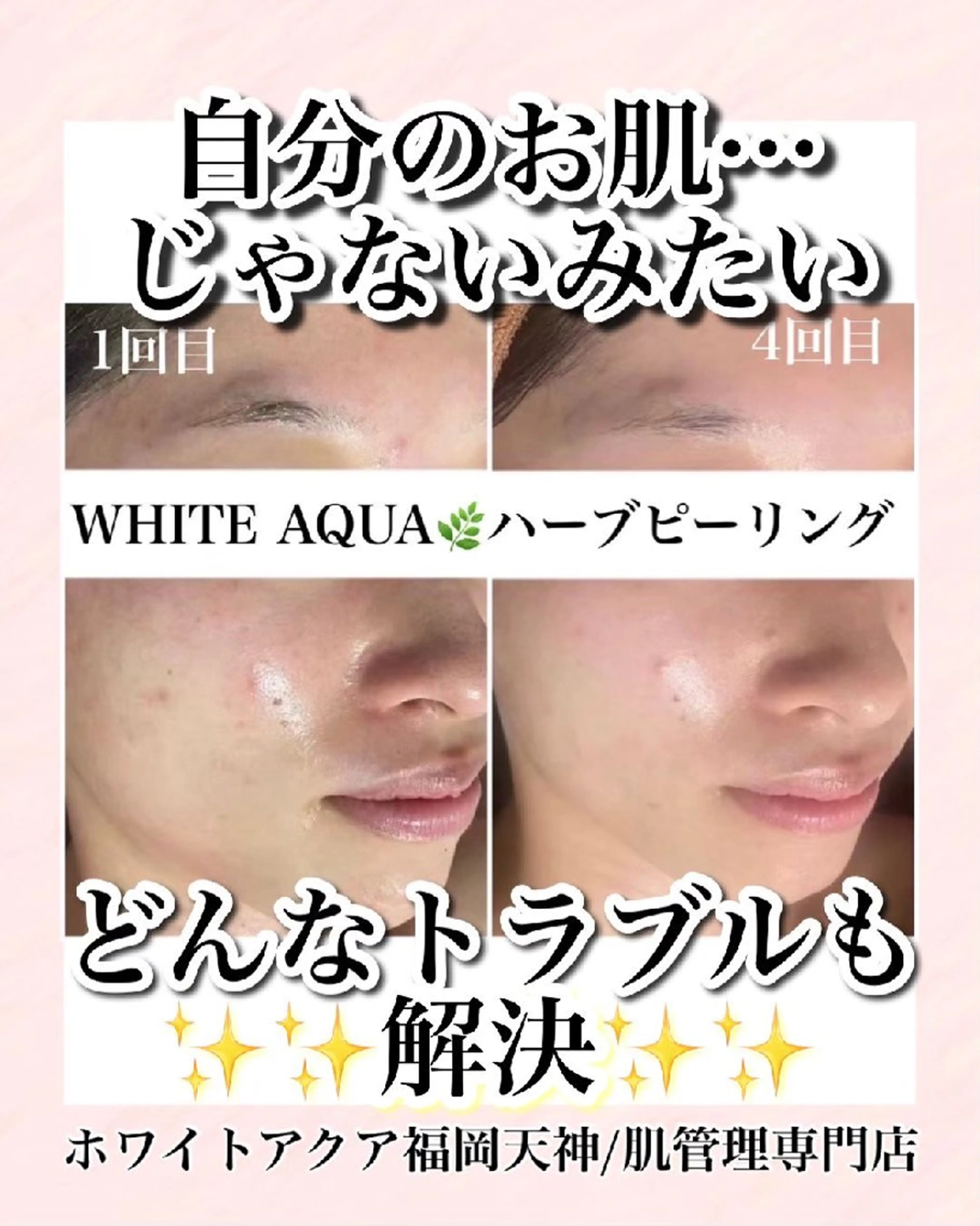 メンズ キッズ WHITEAQUA 福岡天神店のエステ・リラクイメージ