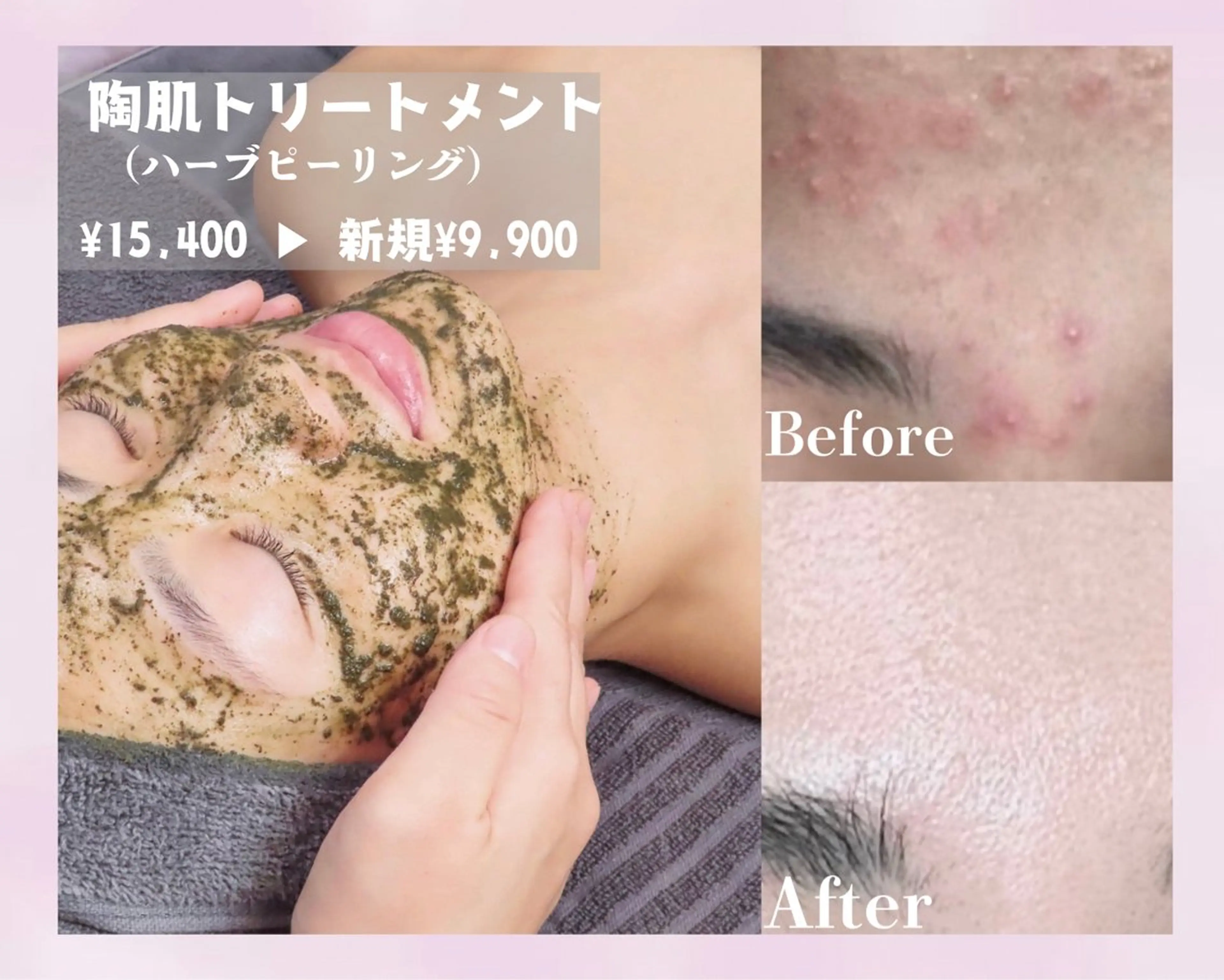 エステ リラク salon SHE° 新宿店🩵のその他イメージ