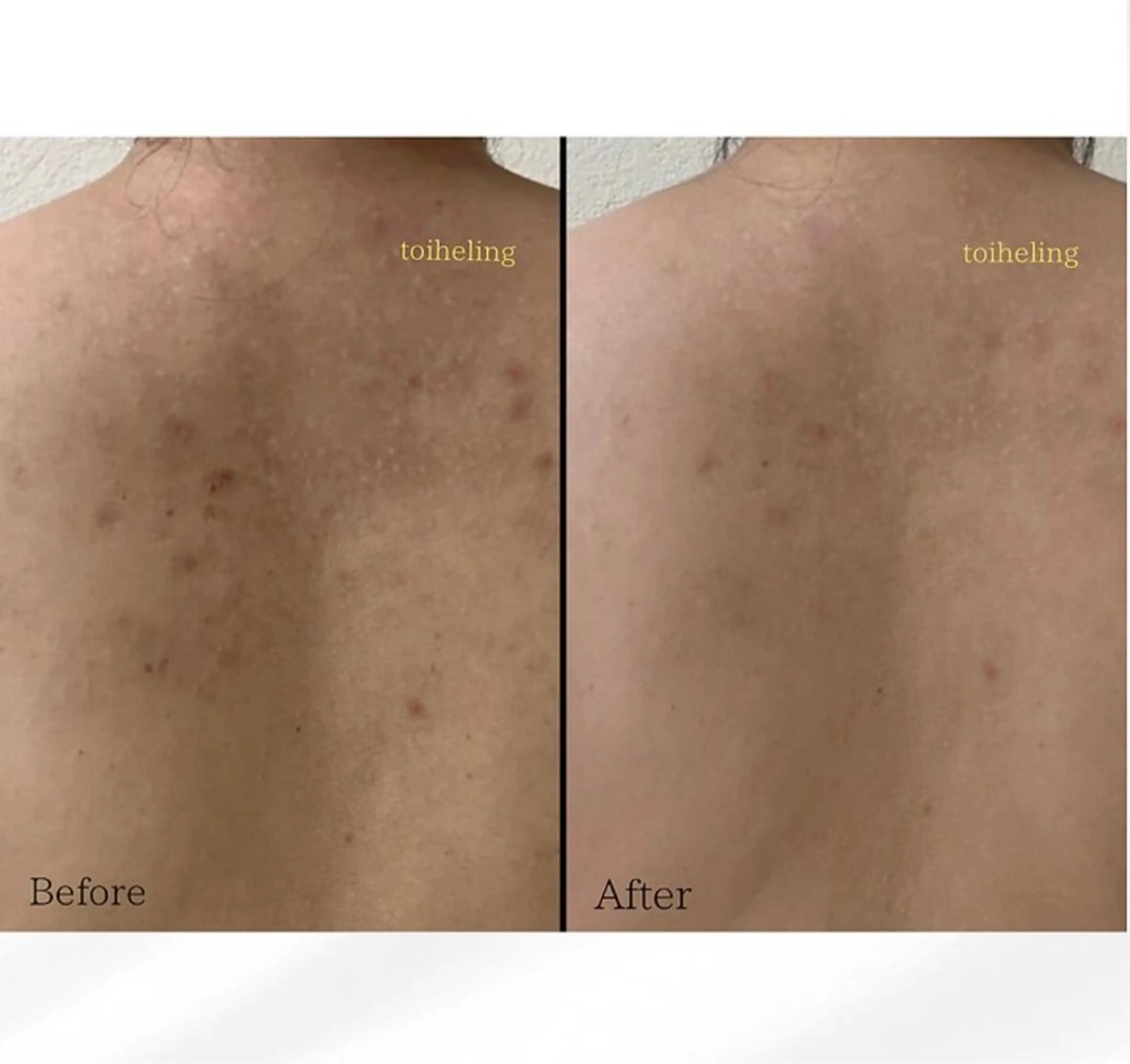 エステ 肌質改善サロン　toihealing所属・肌質改善サロン トワヒーリングのエステ・リラクイメージ