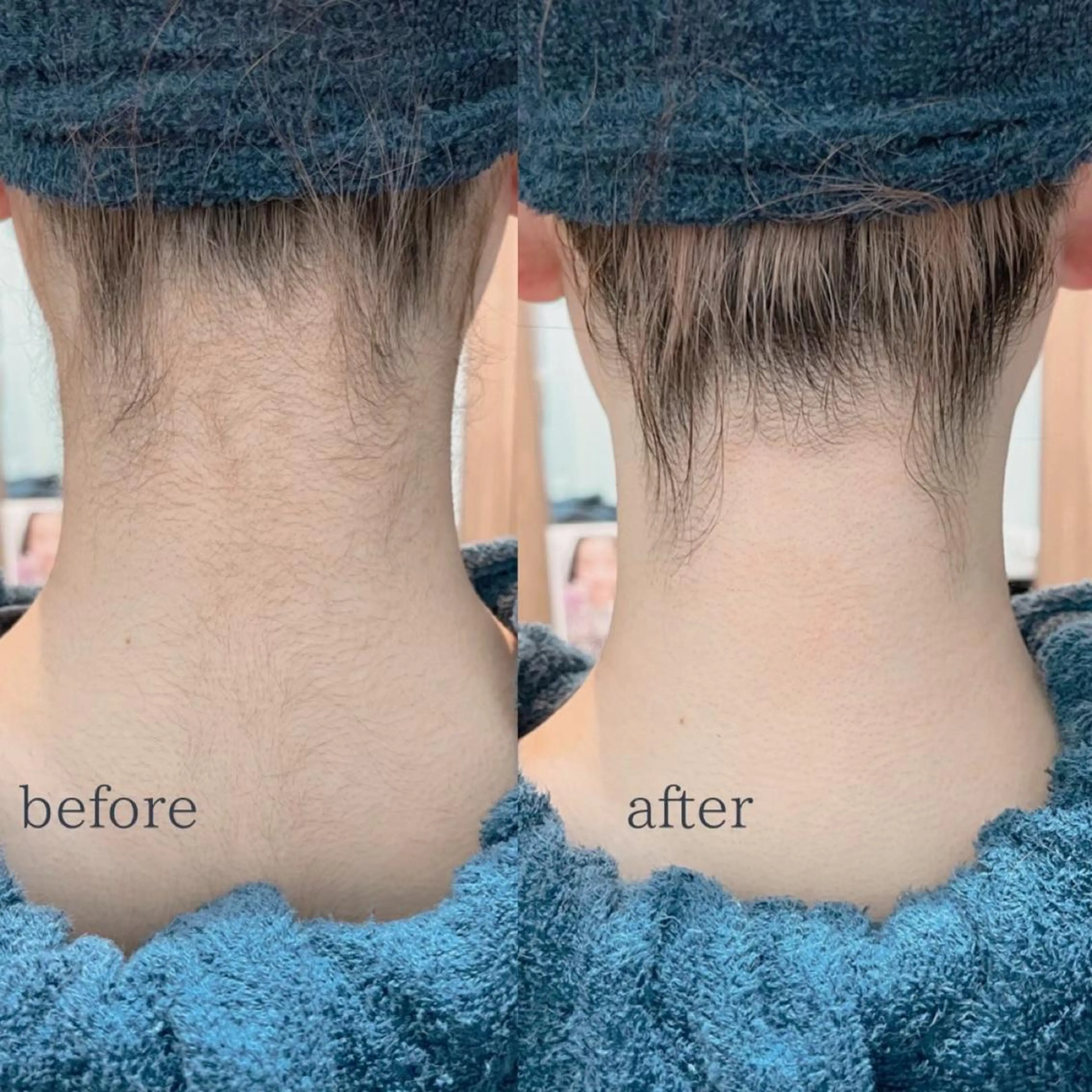 🫧美しい素肌へ🫧 今成柚乃のその他イメージ