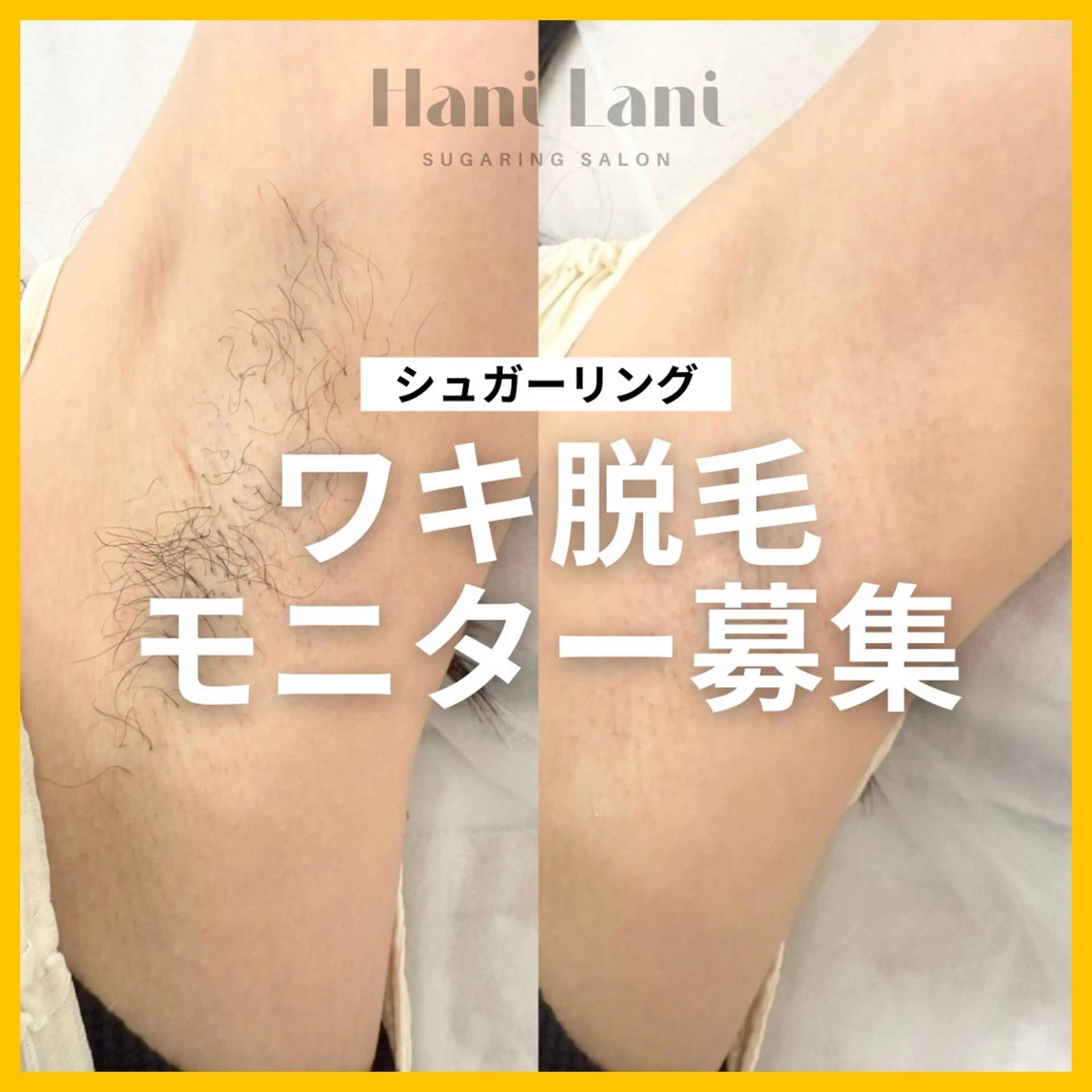 【モニター募集】両ワキ🌻シュガーリングの写真