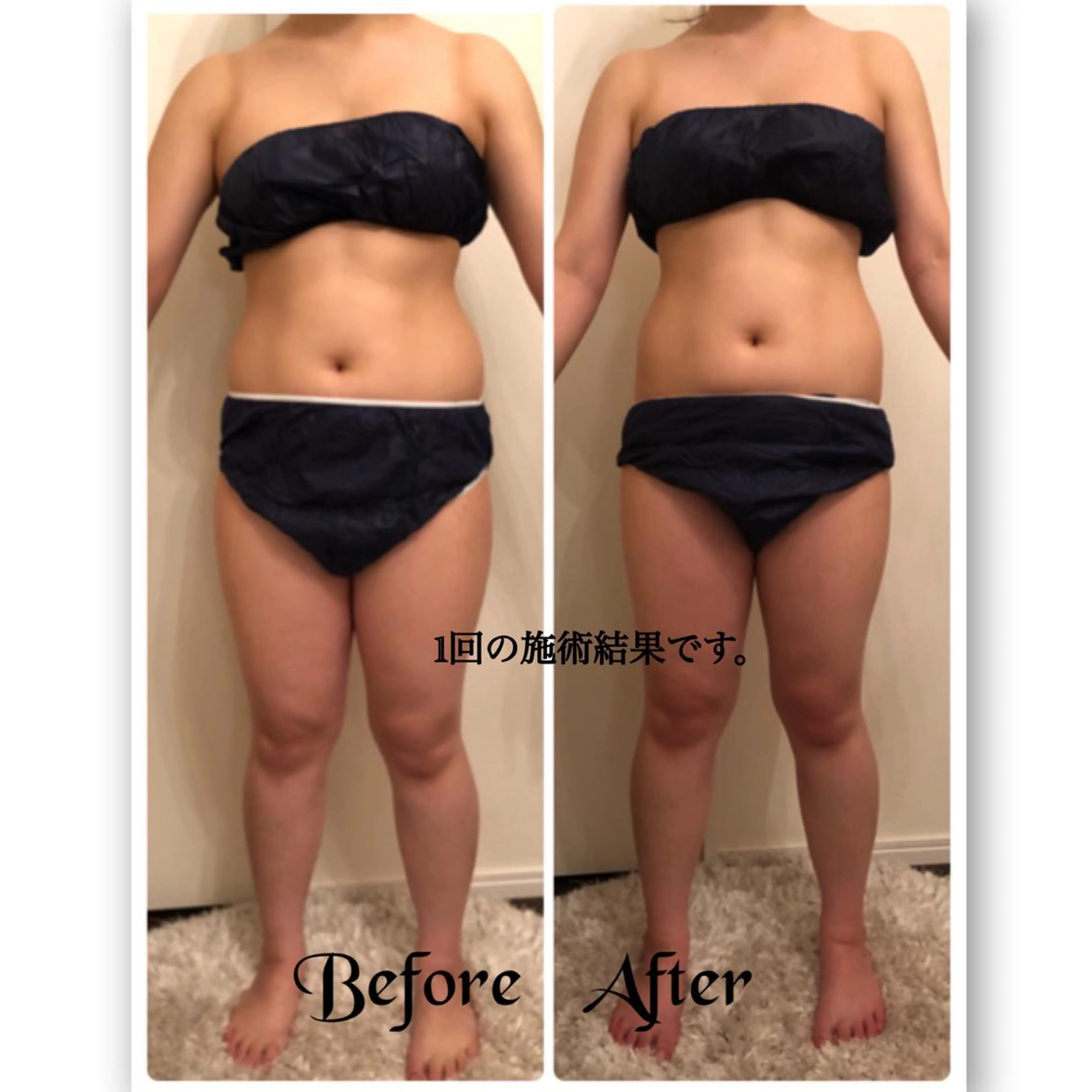 FLEUR大阪・整体 ・ハイフ・痩身・小顔のエステ・リラクイメージ