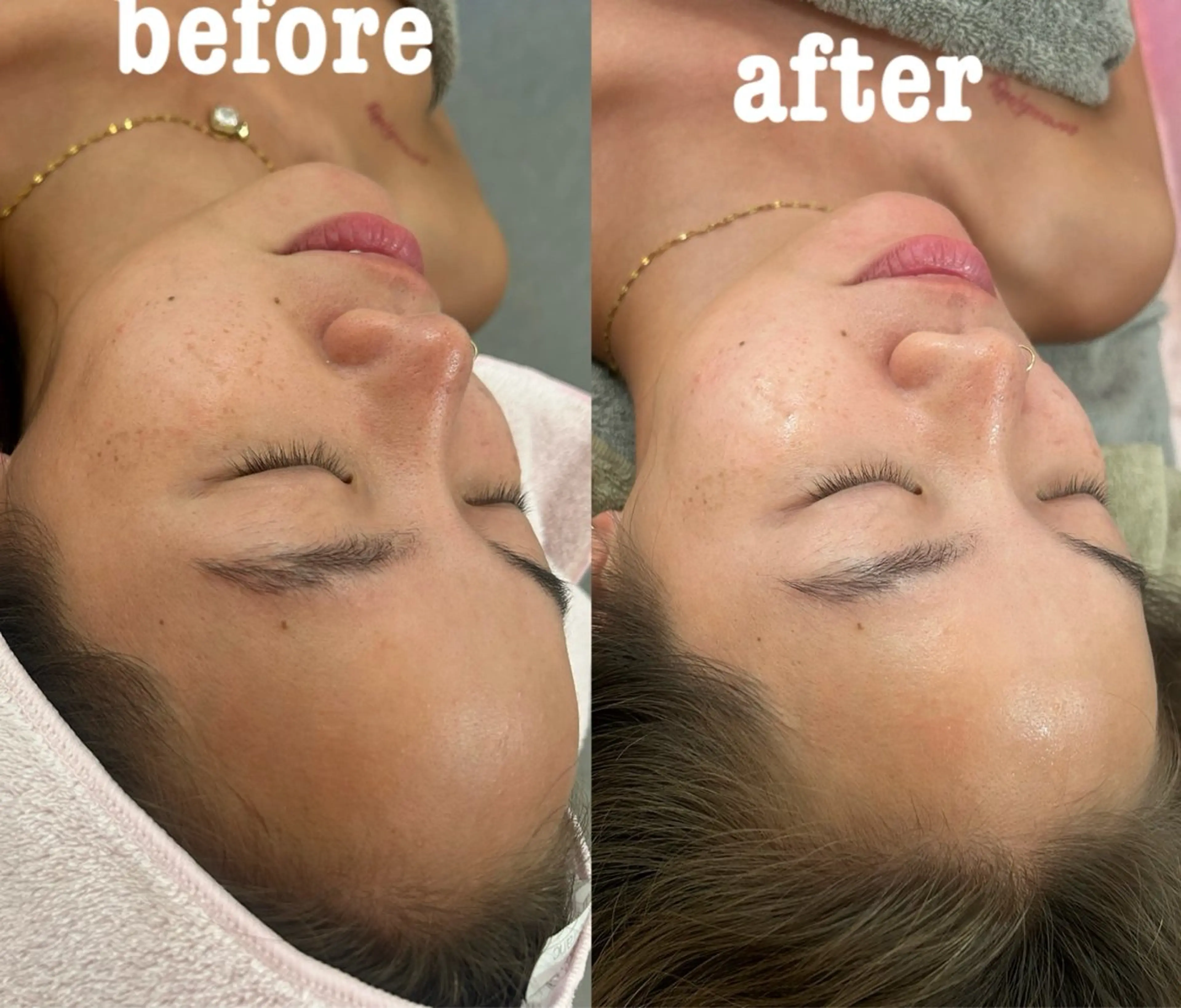 美容鍼灸サロン mahoroba院長のエステ・リラクイメージ