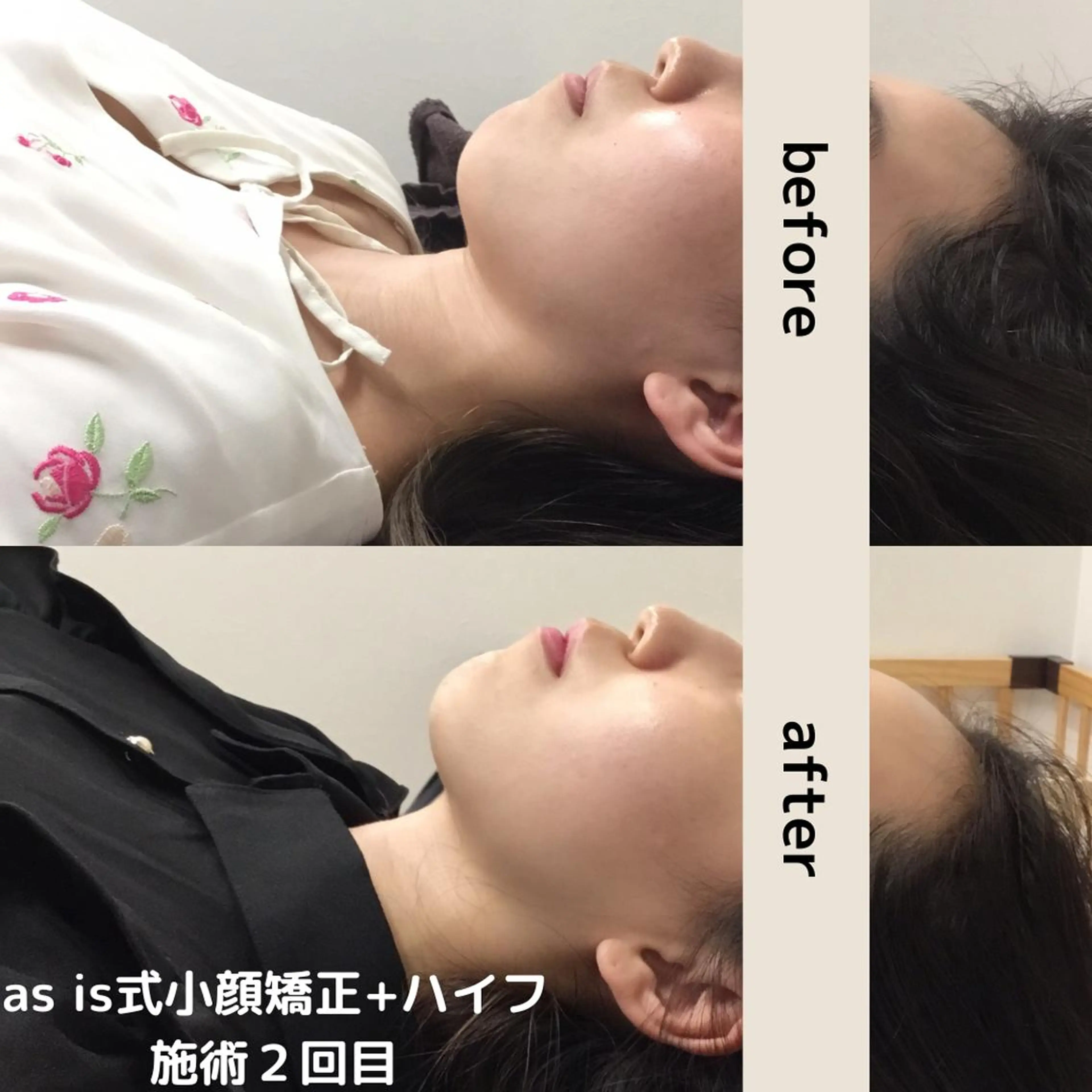 小顔専門アズイズ ビューティー　草津店のエステ・リラクイメージ