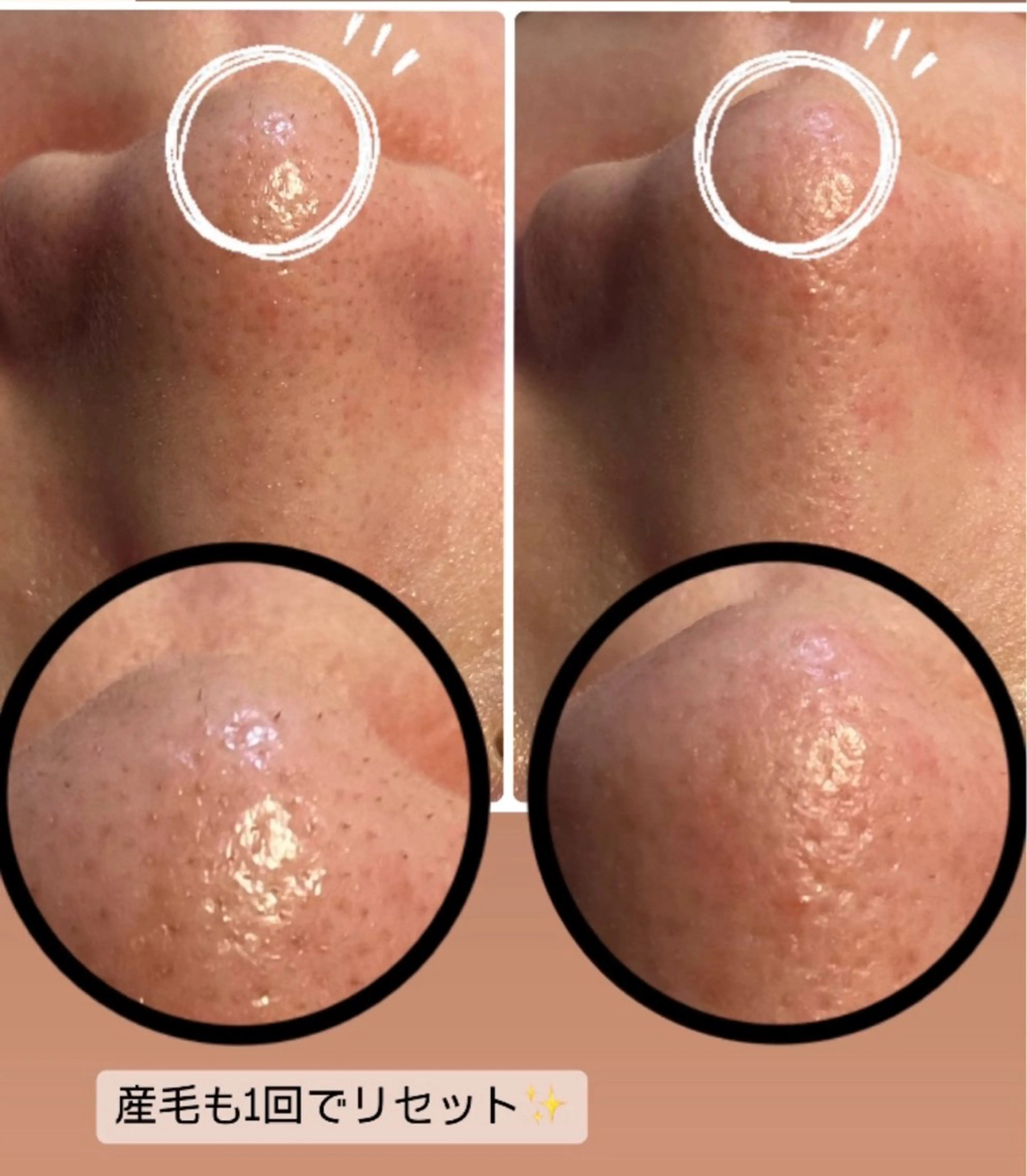 エステ リラク ピーリング専門店 Belluteのエステ・リラクイメージ