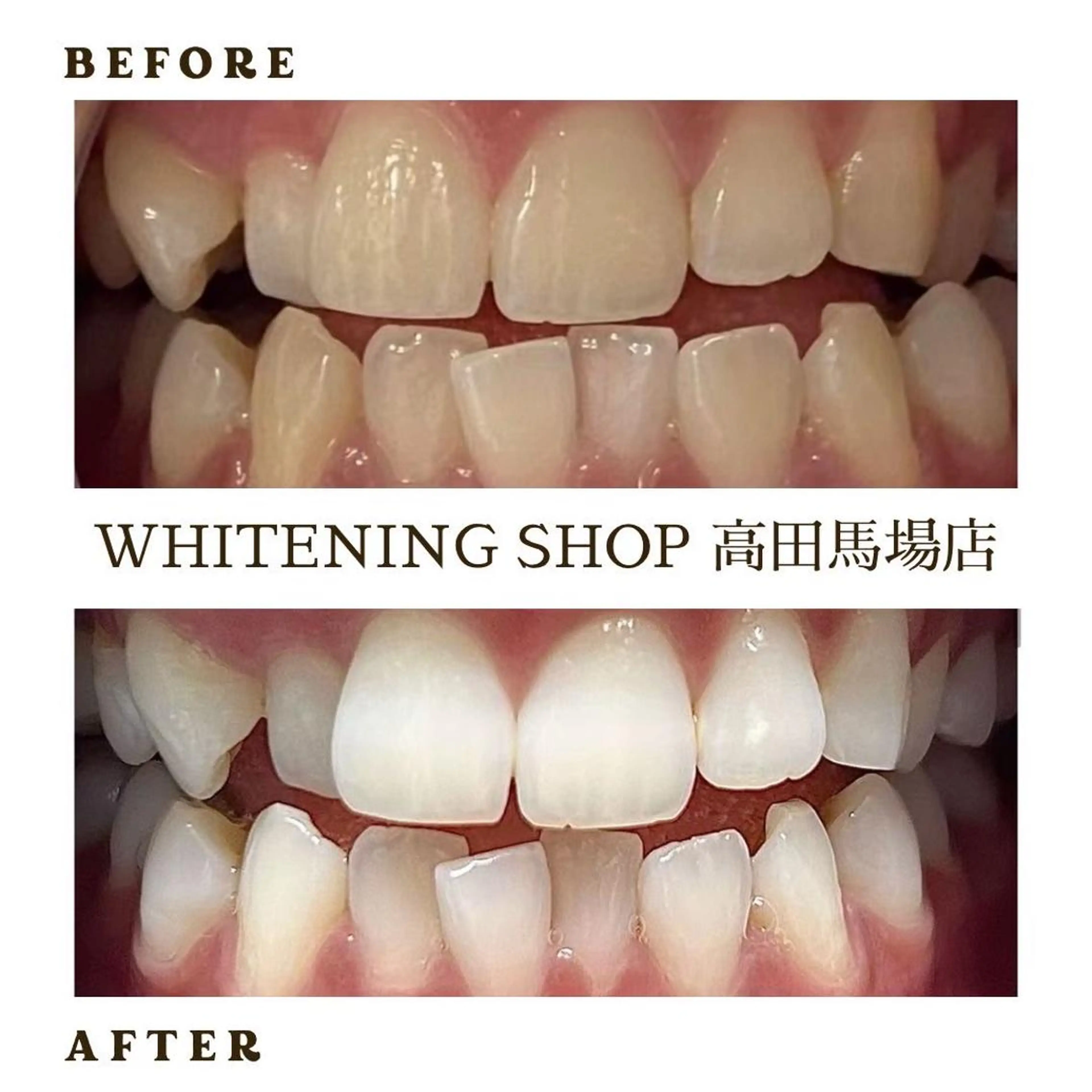 メンズ メンズ就活ヘア その他 ホワイトニング ショップ高田馬場店のその他イメージ