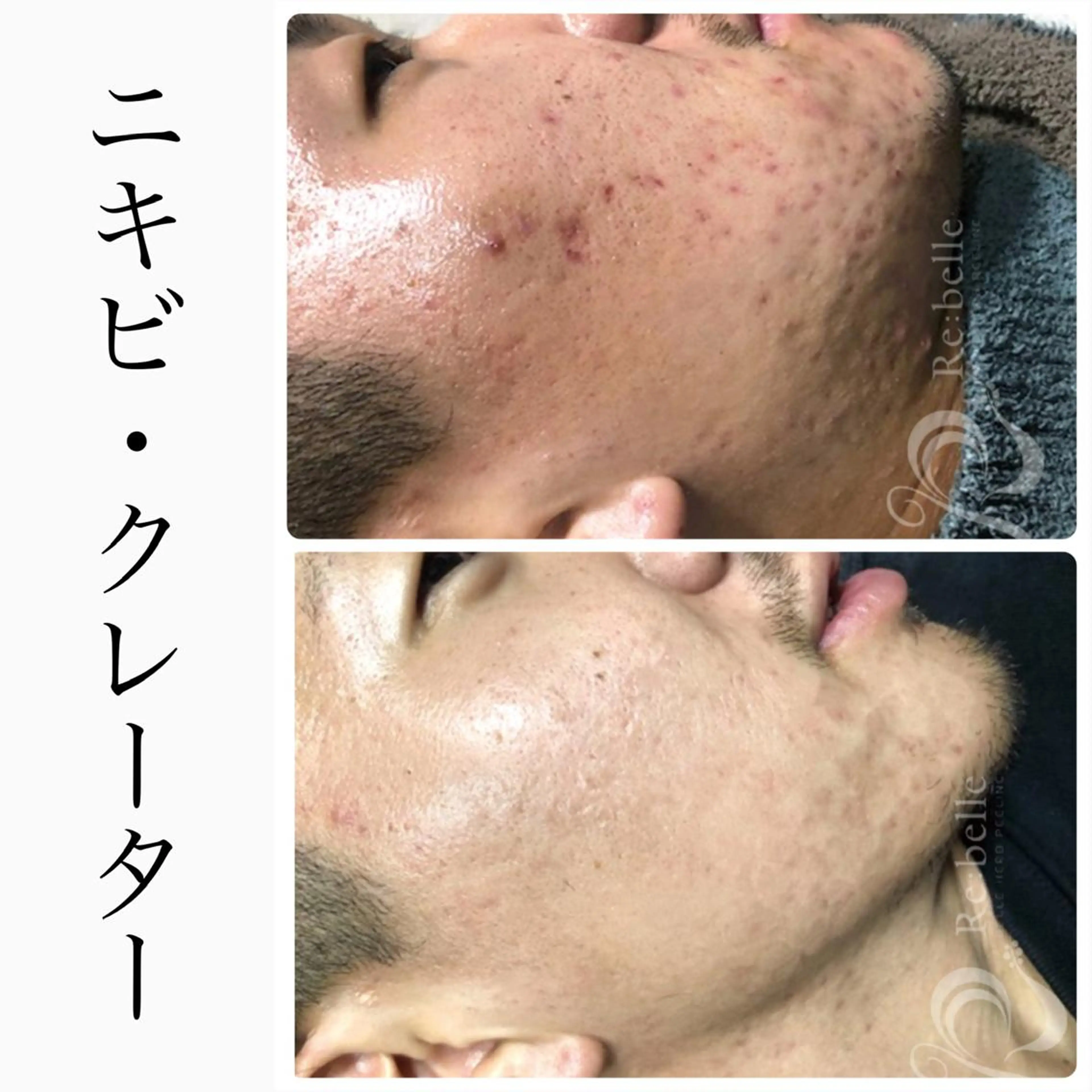 エステ ハーブピーリング専門 BIOEL横浜のエステ・リラクイメージ