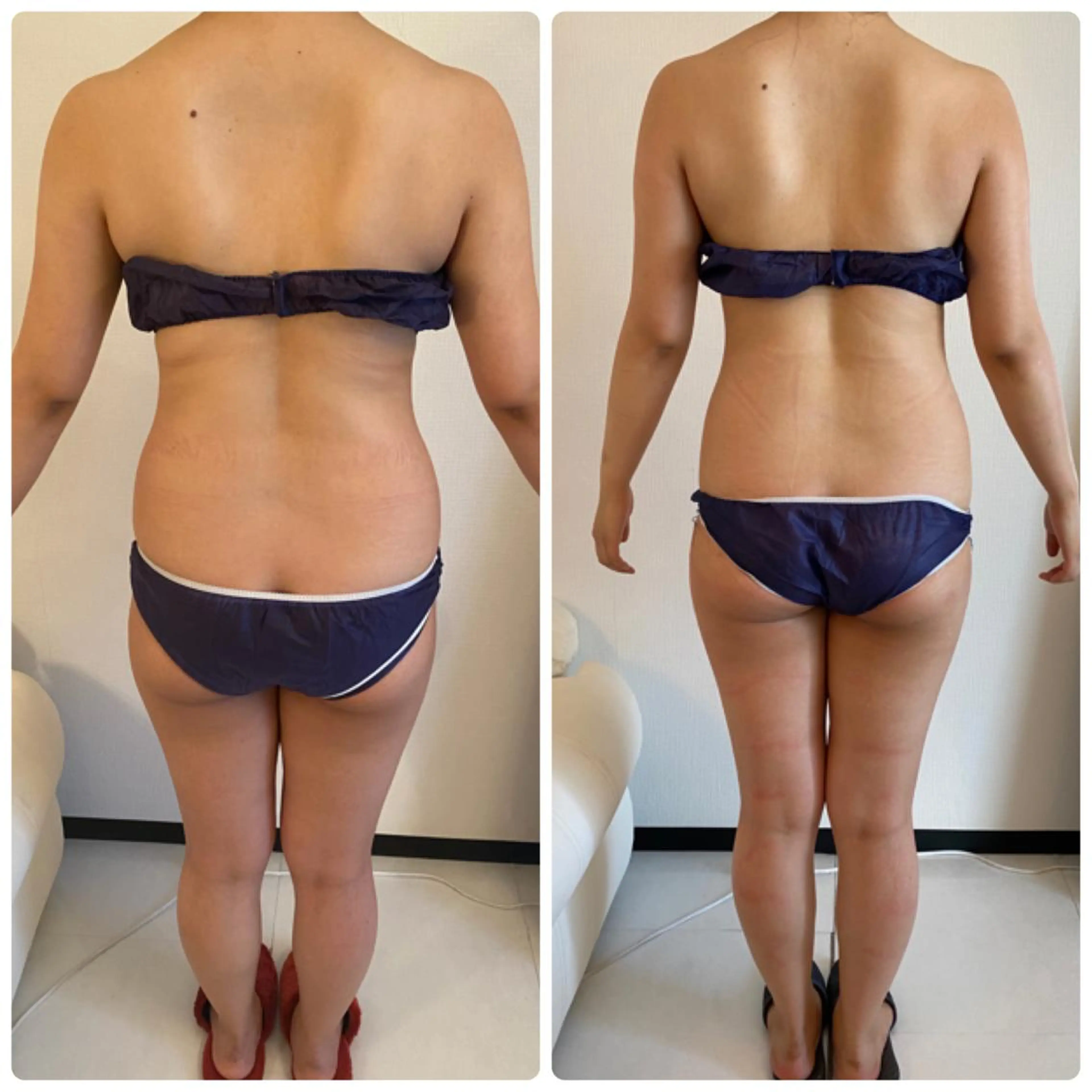 FLEUR大阪・整体 ・ハイフ・痩身・小顔のエステ・リラクイメージ