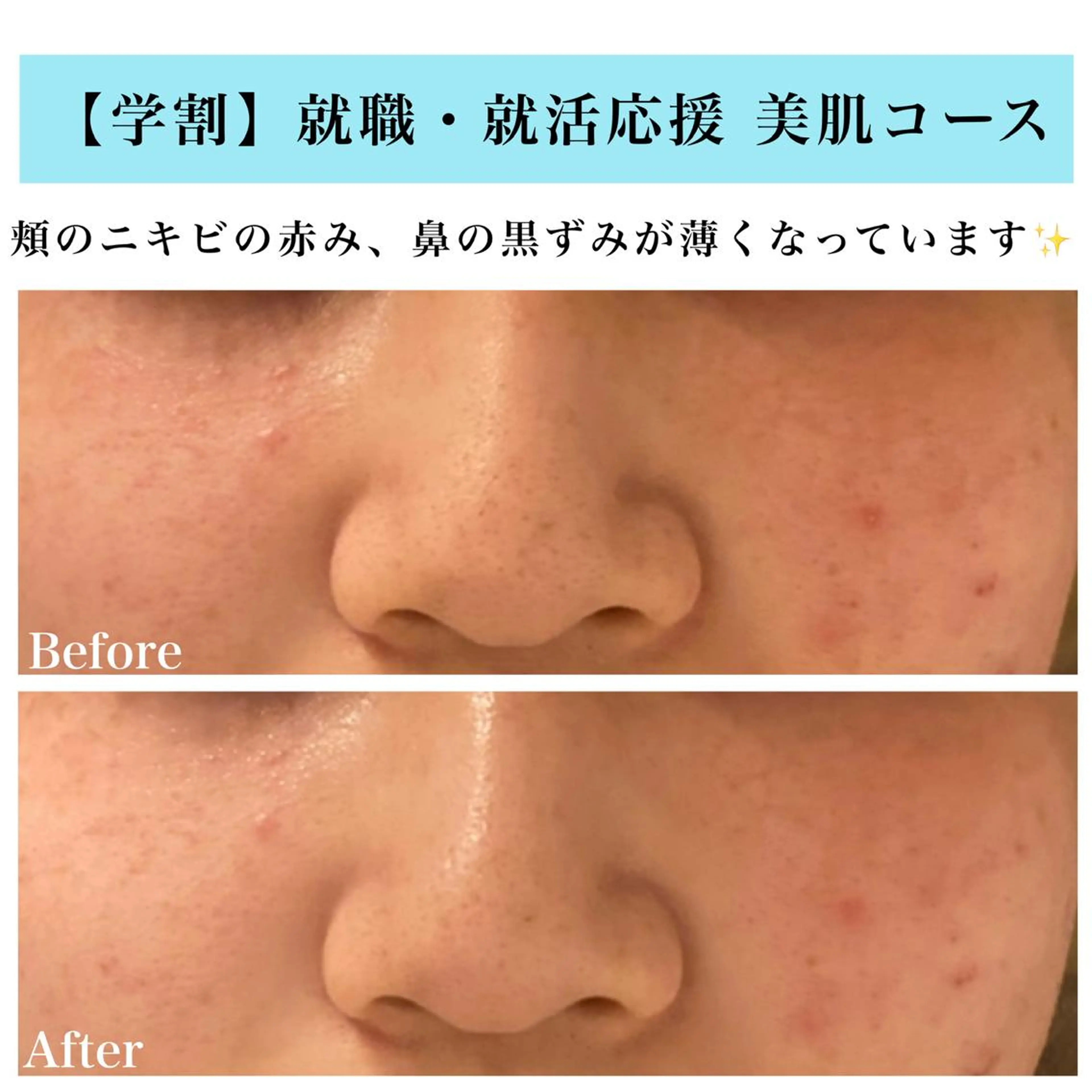 エステ Bellesthe (ベルエステ)のエステ・リラクイメージ