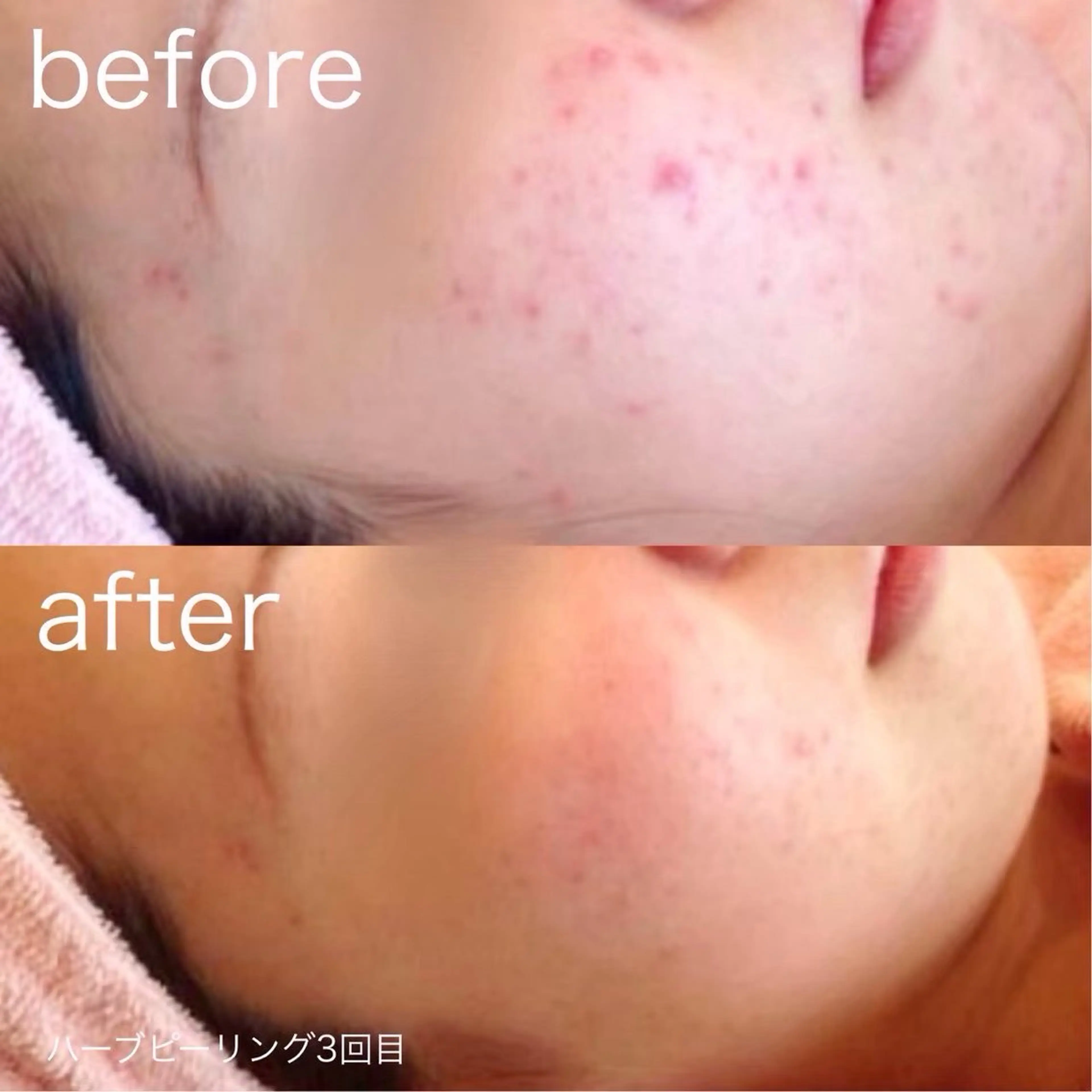 その他 lulula ricoのエステ・リラクイメージ