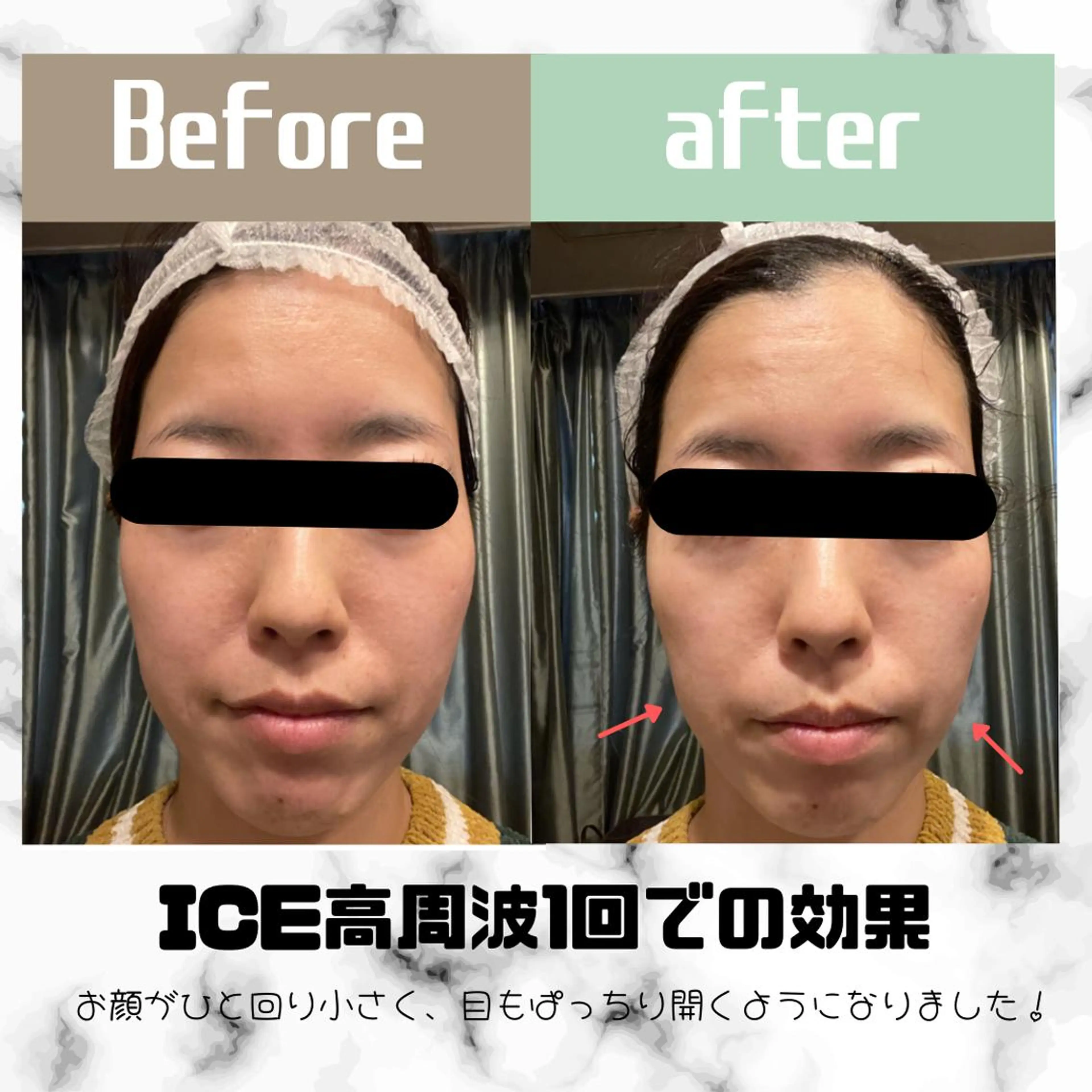 メンズ 男女同額完全個室脱毛 LEPIA内田のエステ・リラクイメージ