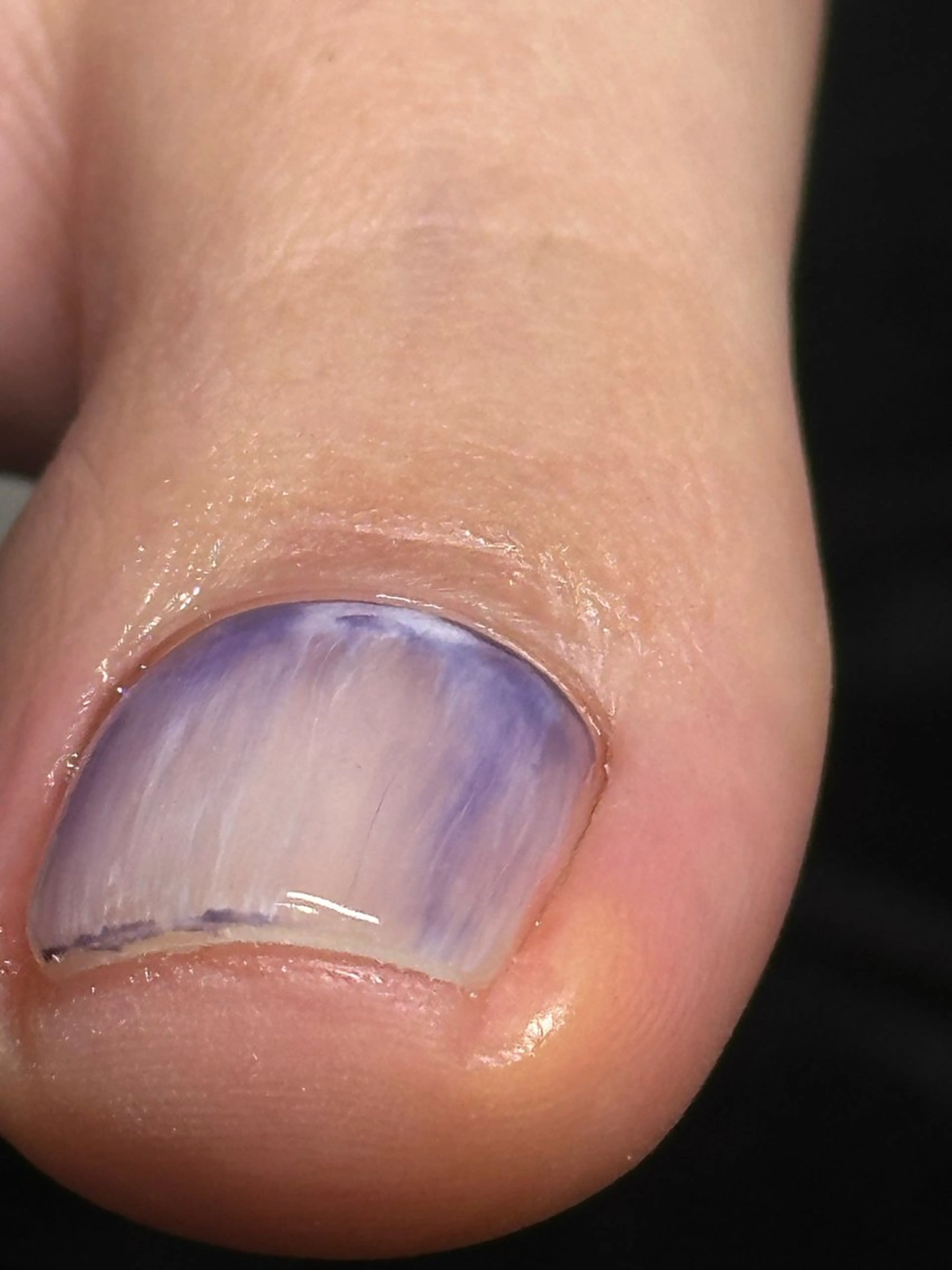 ネイル m o m o / 高岡ネイルのネイルデザイン