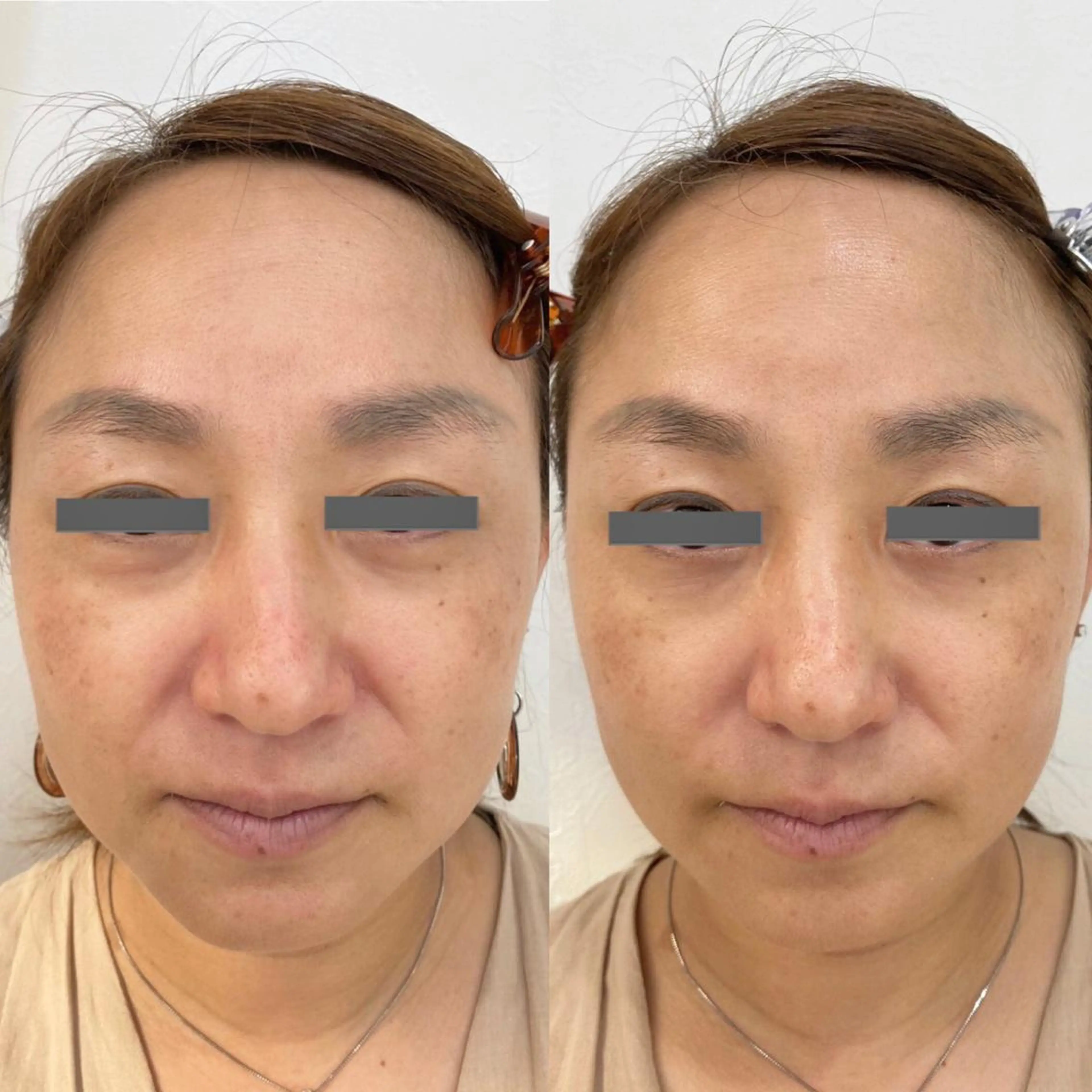 エステ リラク ポーラザビューティー 松原店のエステ・リラクイメージ