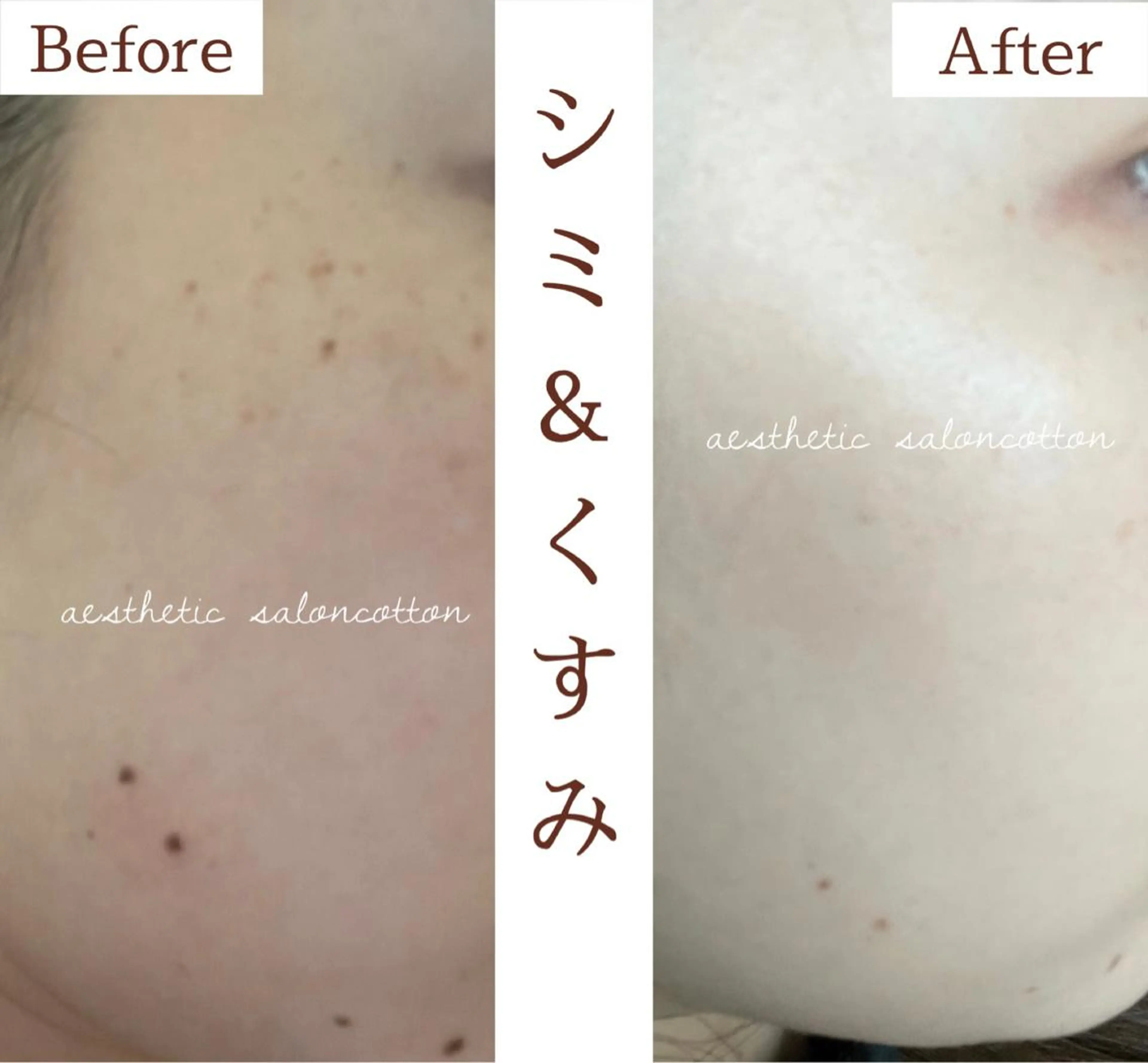 エステ 都度払い 肌質改善専門サロンのエステ・リラクイメージ