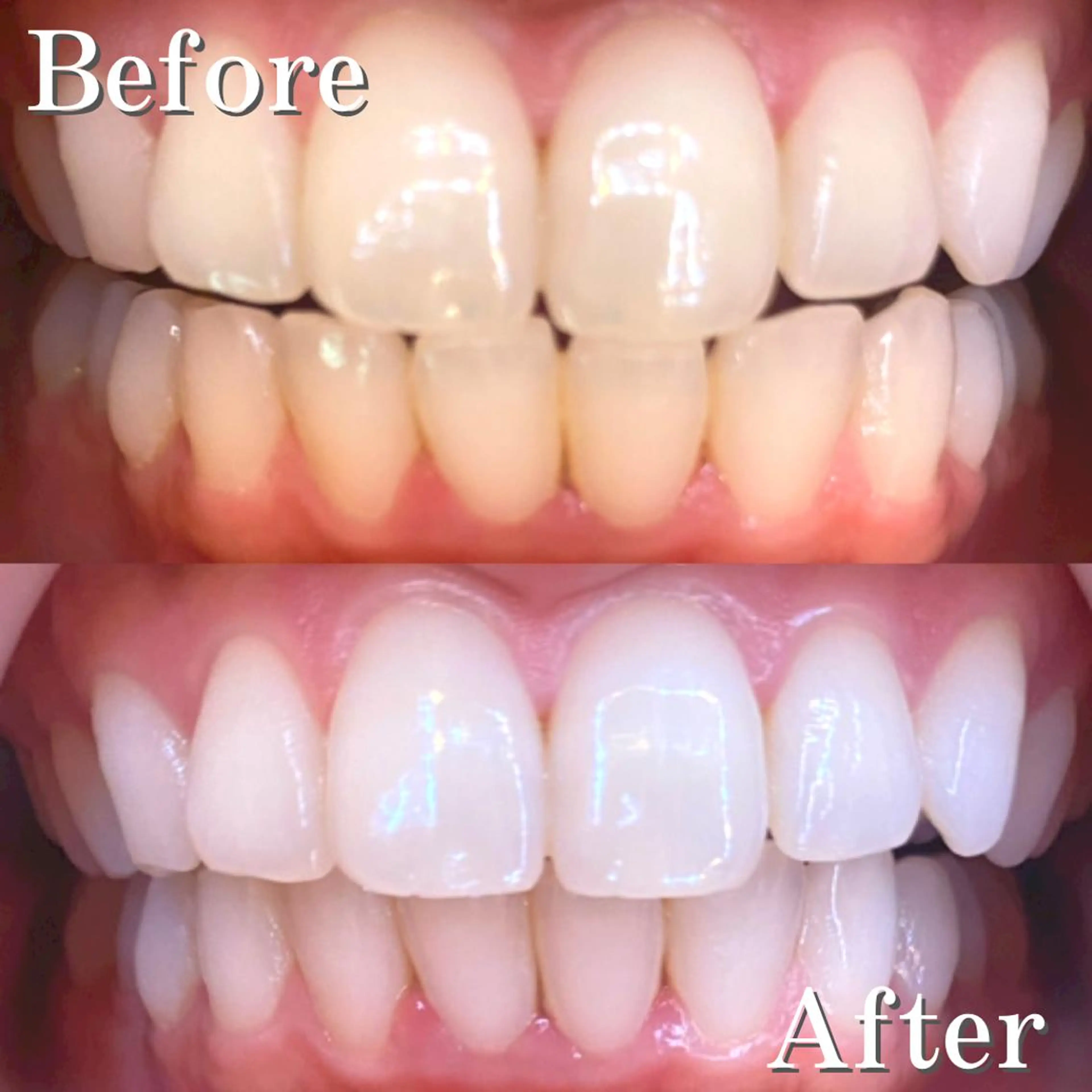 アイブロウ マツエク・マツパ メンズ ヘアアレンジ セミロング 結婚式・ブライダル メンズアイブロウ 結婚式・ブライダル その他 LBSホワイトニング 銀座店💎公式のその他イメージ