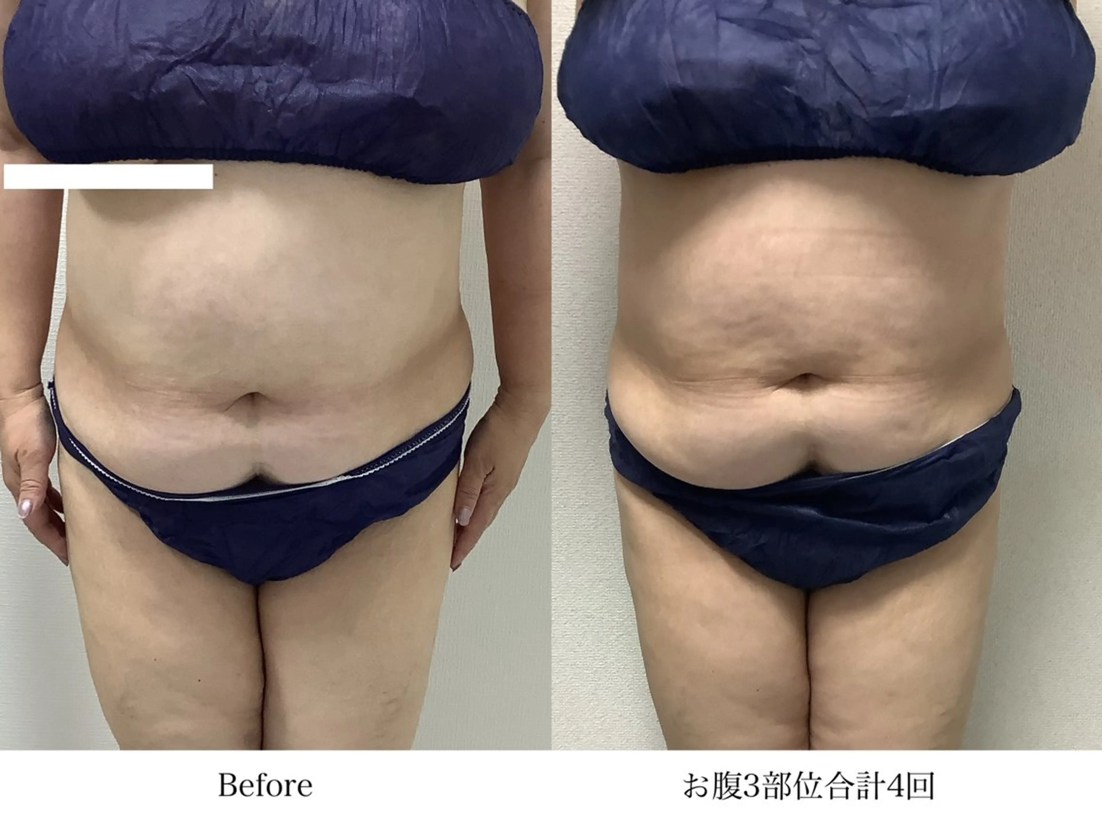 冷却専門店 SLARIのエステ・リラクイメージ