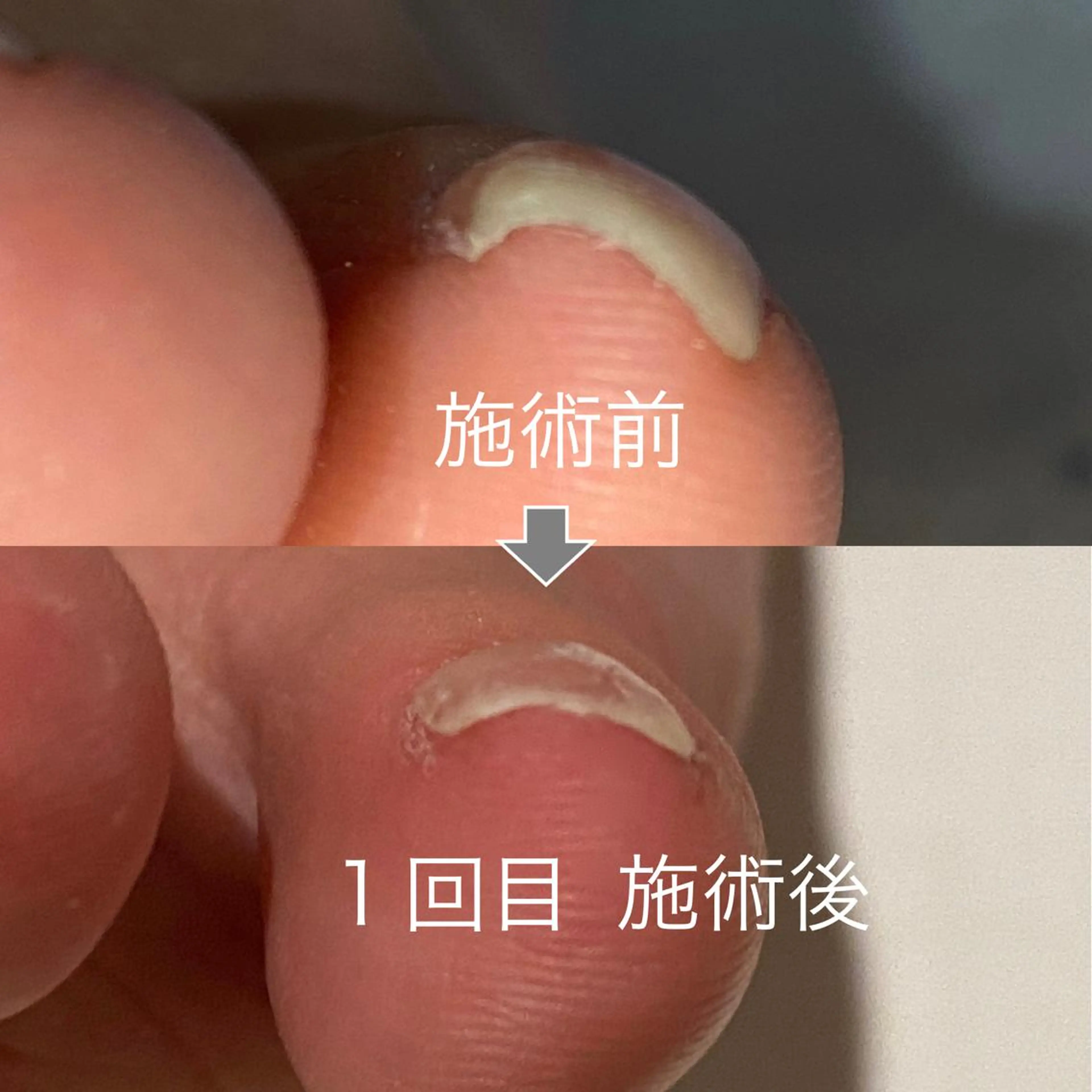ネイル フットネイル プライベートサロン Rのネイルデザイン