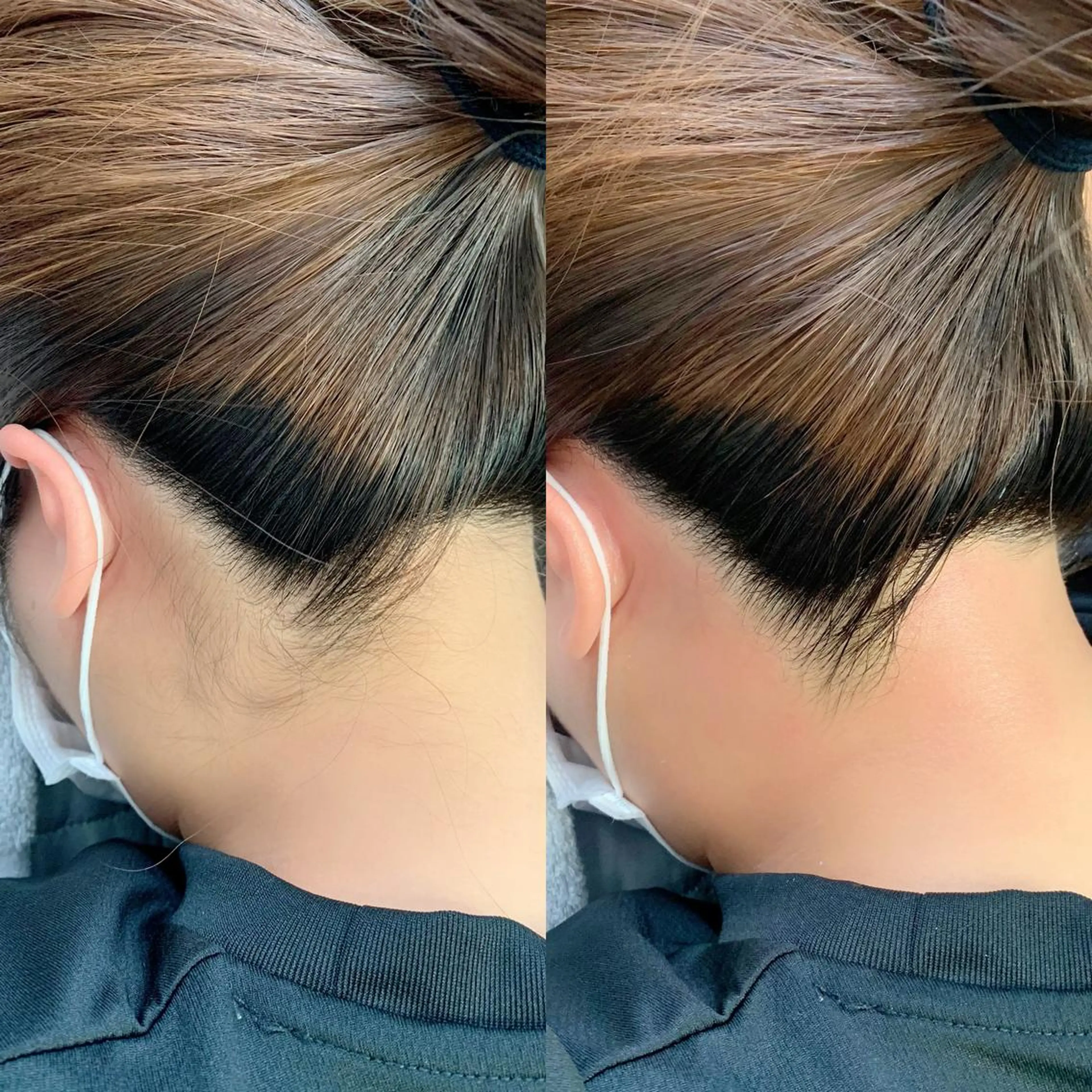 脱毛 salonLADYSTYLE所属・稲嶺 美華のエステ・リラクイメージ