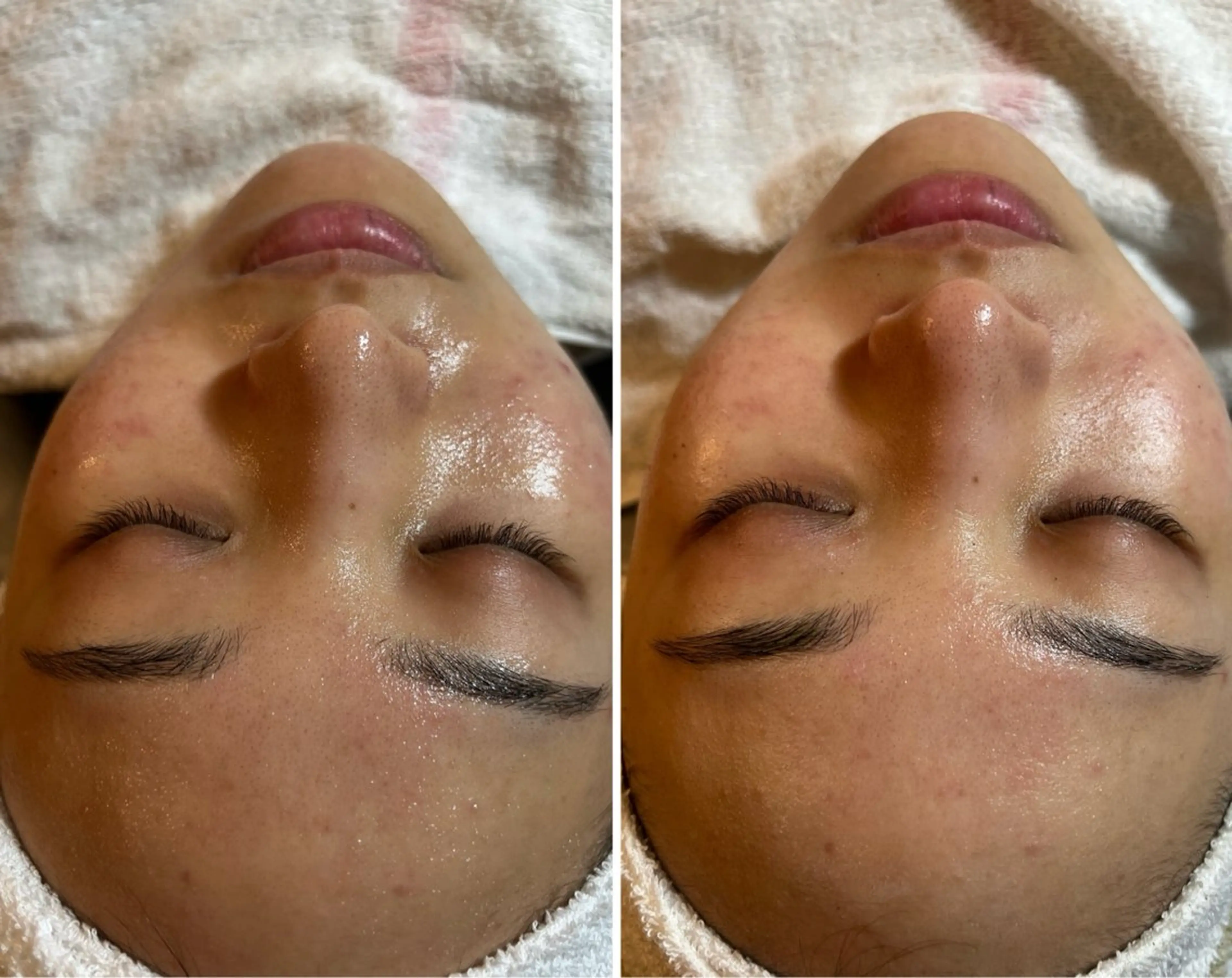 esty hitomiのエステ・リラクイメージ