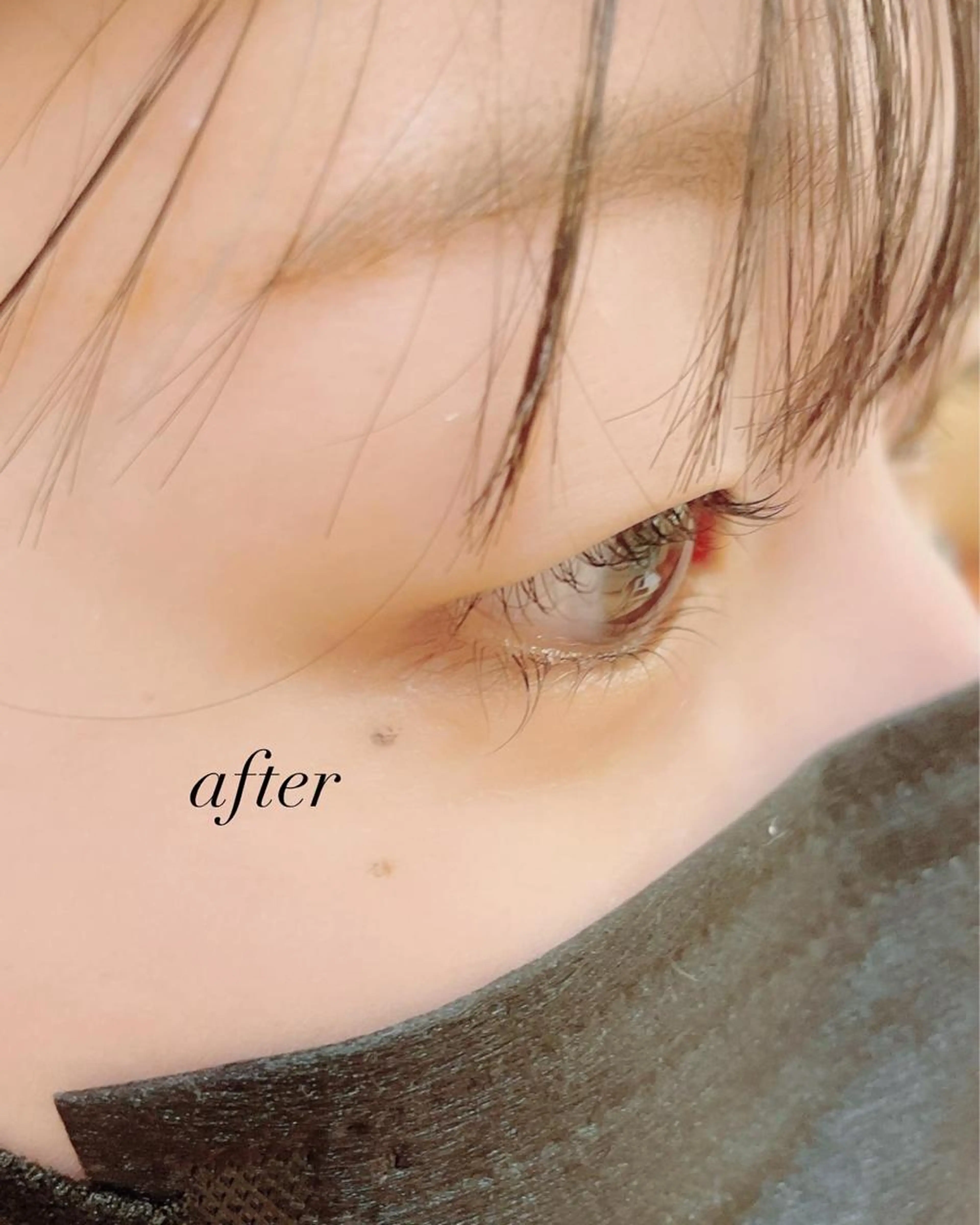 マツパ（下まつげのみです）の写真