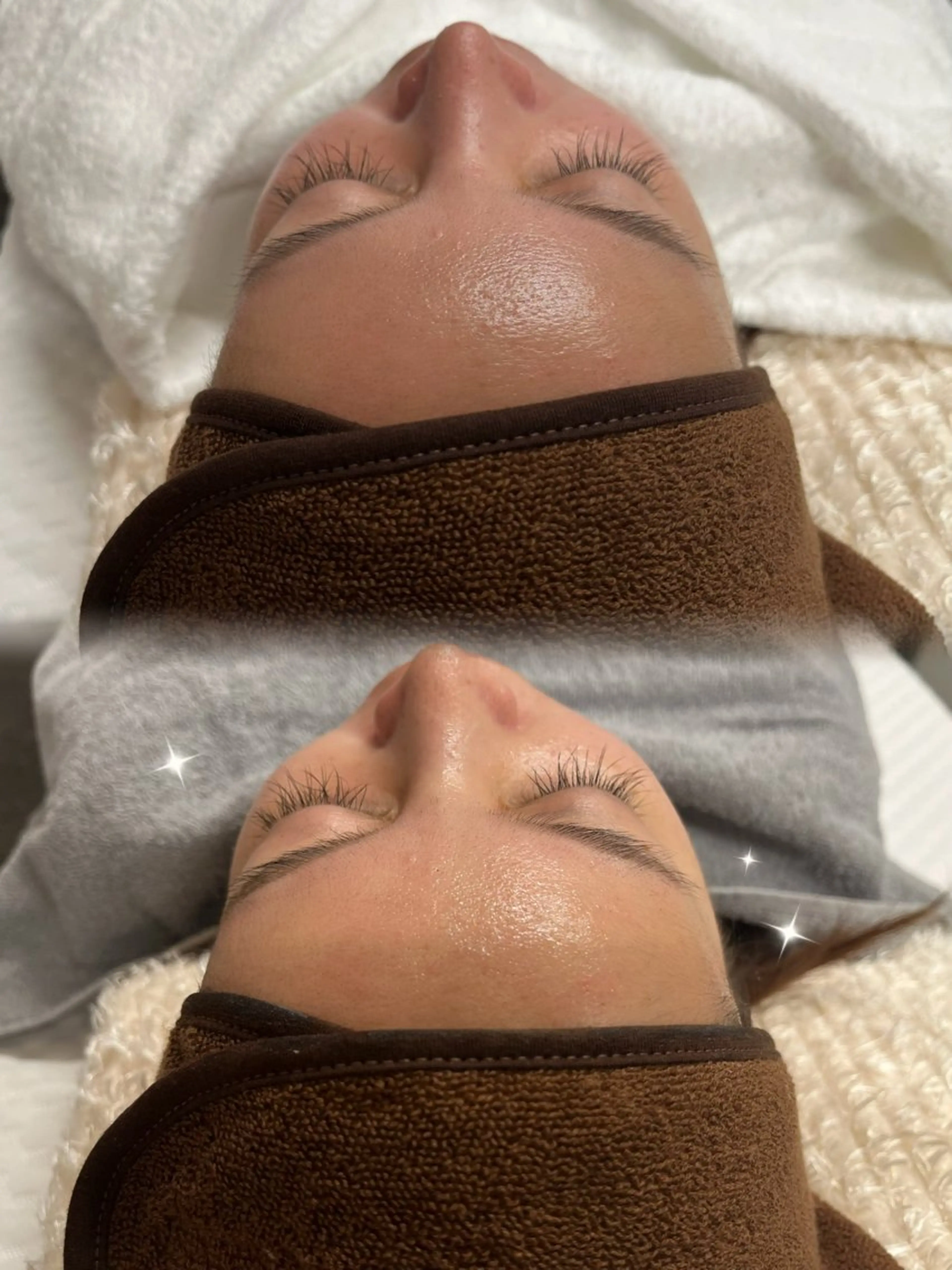 ハーブピーリング(剥離無) 【通常】¥5000▶︎【オープン記念価格】¥4660の写真