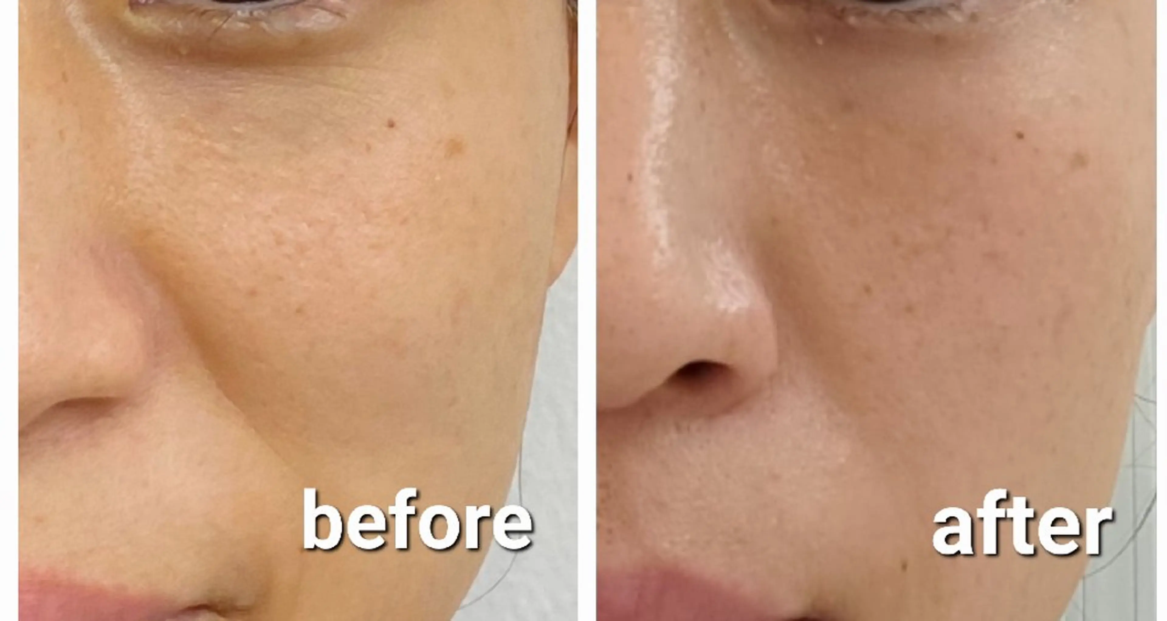 ハーブ温熱ケアサロン【BISKI】所属・ハーブ温熱ケアサロン 【BISKI 】のエステ・リラクイメージ