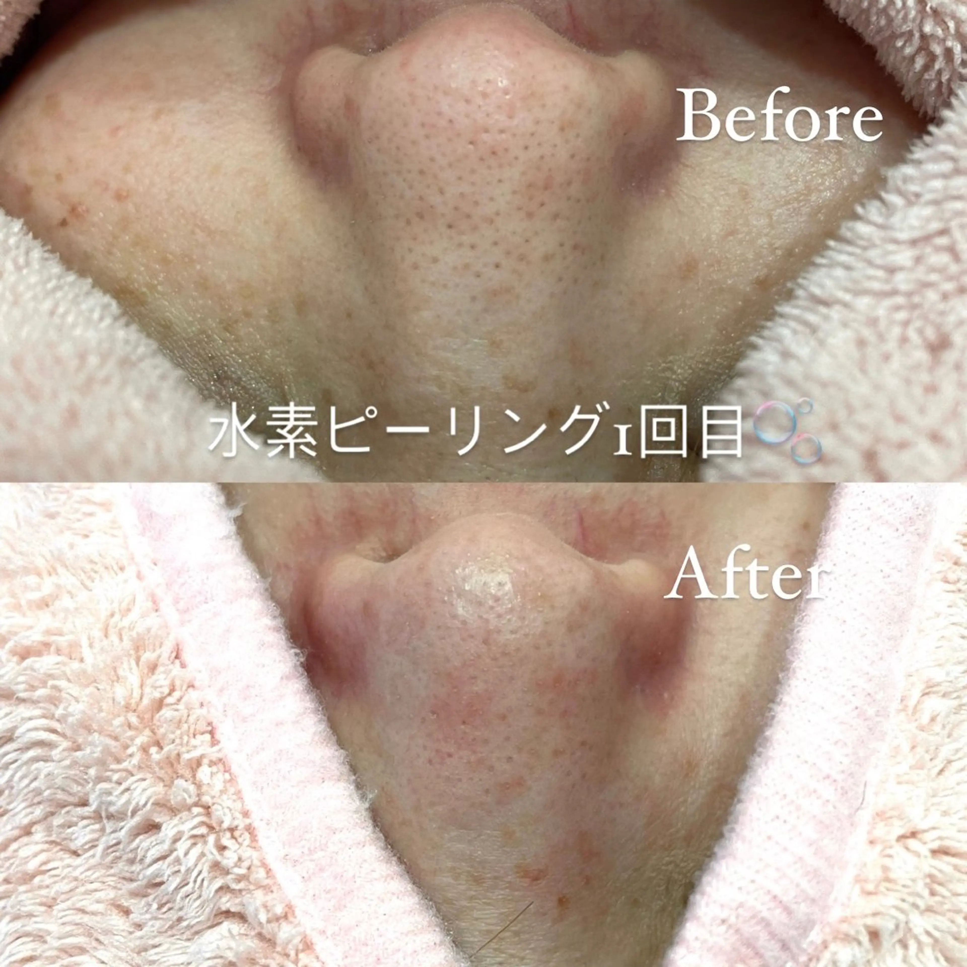 KUGO SALON所属・KUGO SALON _MARINOのその他イメージ