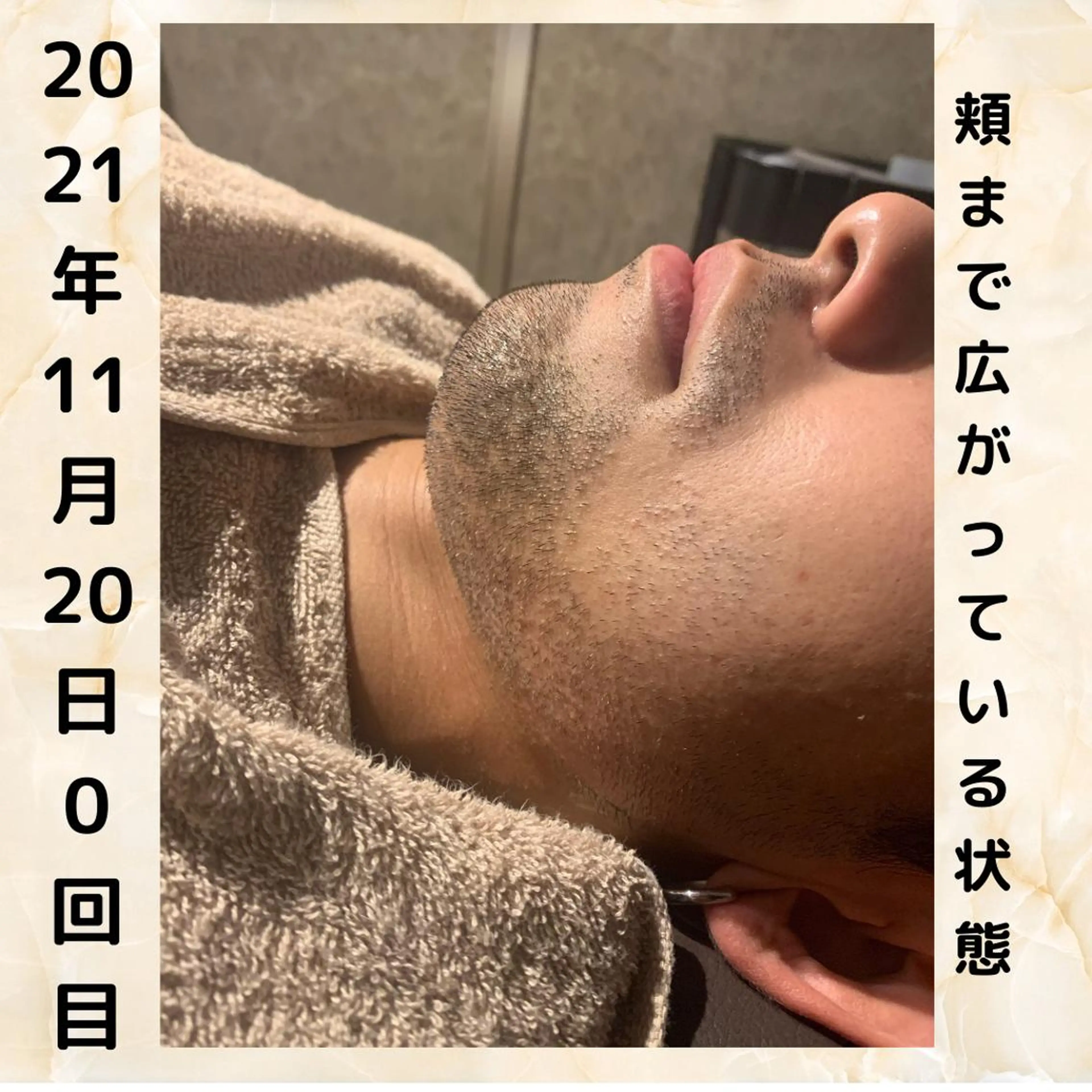 メンズ 20代から始める脱毛 salonLEPIAのエステ・リラクイメージ