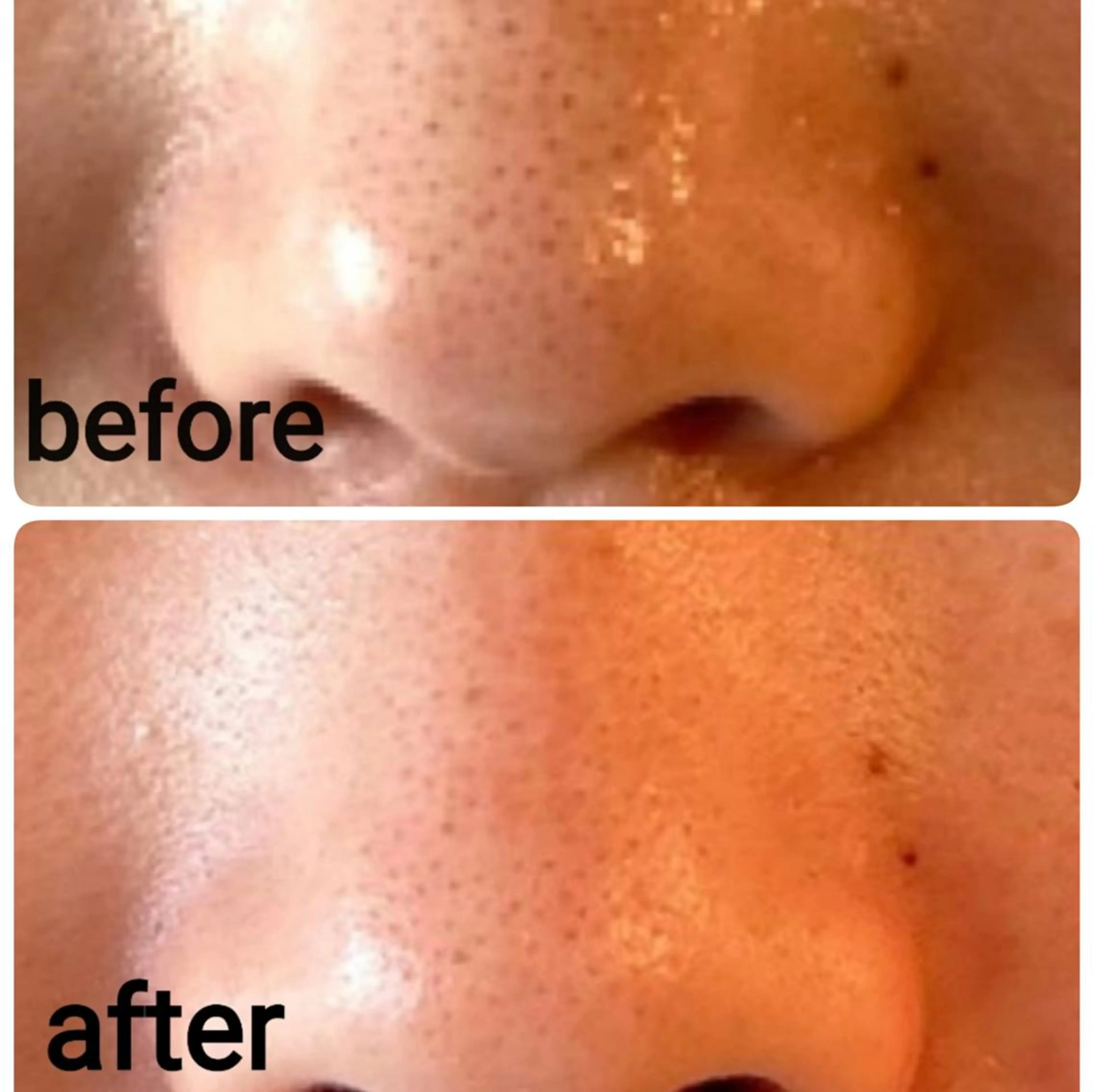 肌ケア&毛穴洗浄 Cheriのエステ・リラクイメージ