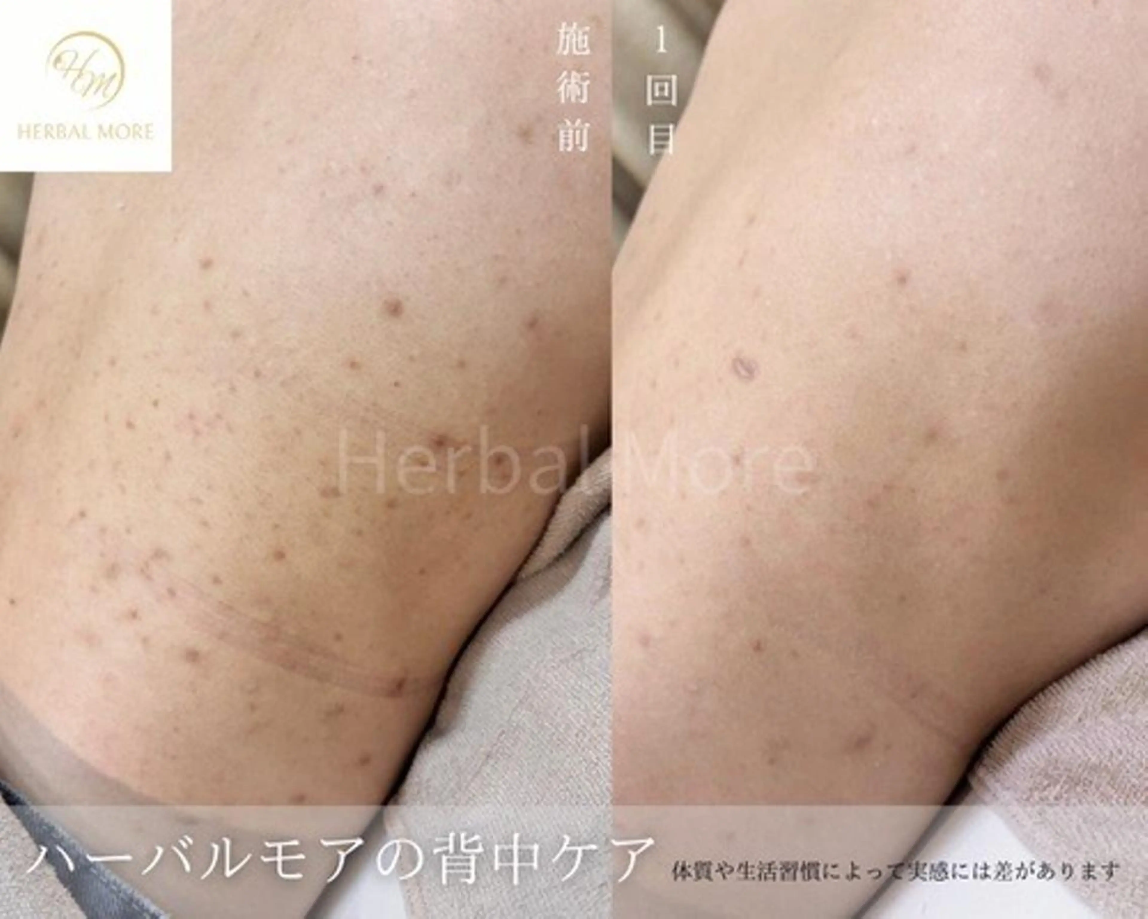 脱毛・眉毛・フェイス サロンN久留米店のその他イメージ