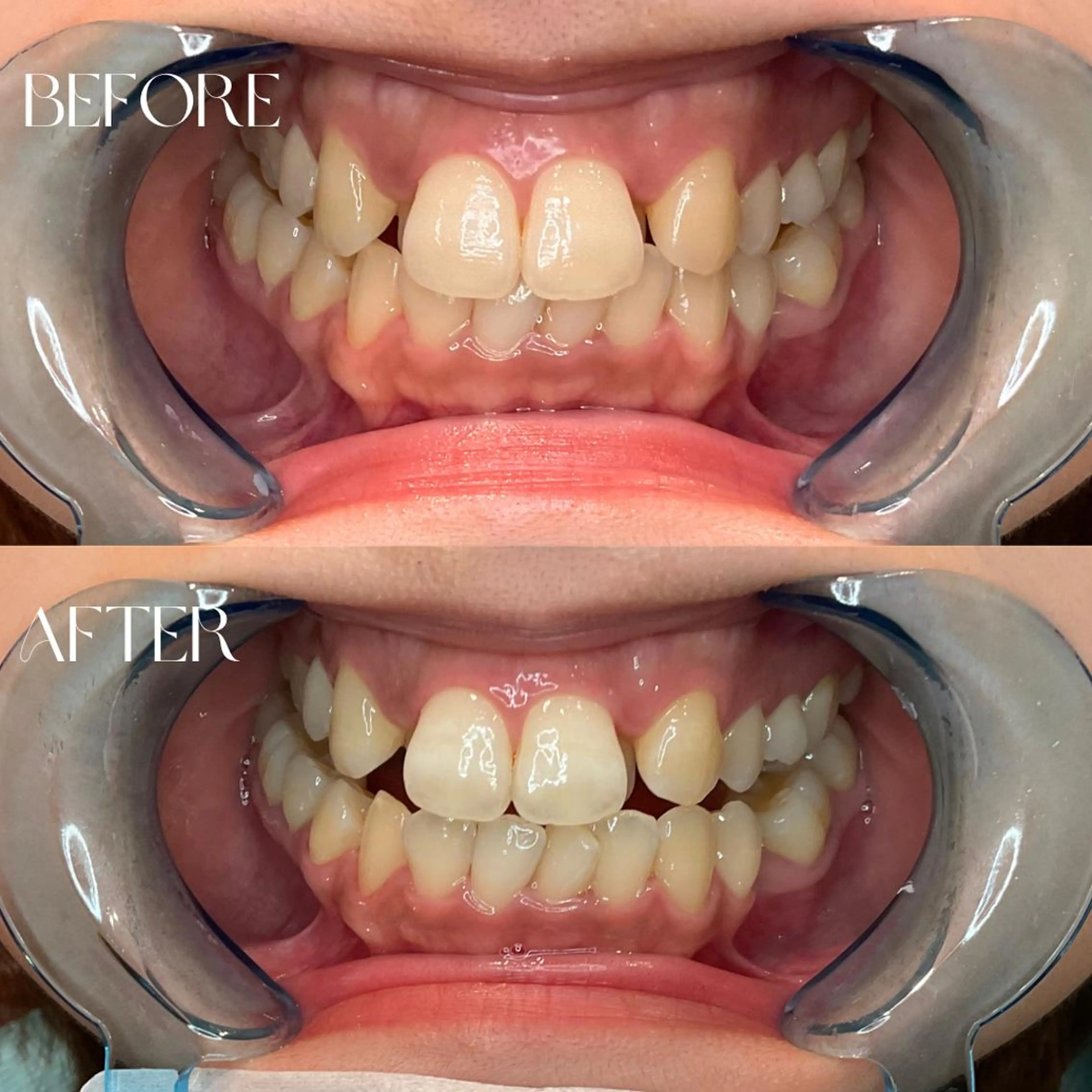 その他 B-st. 下北沢のその他イメージ