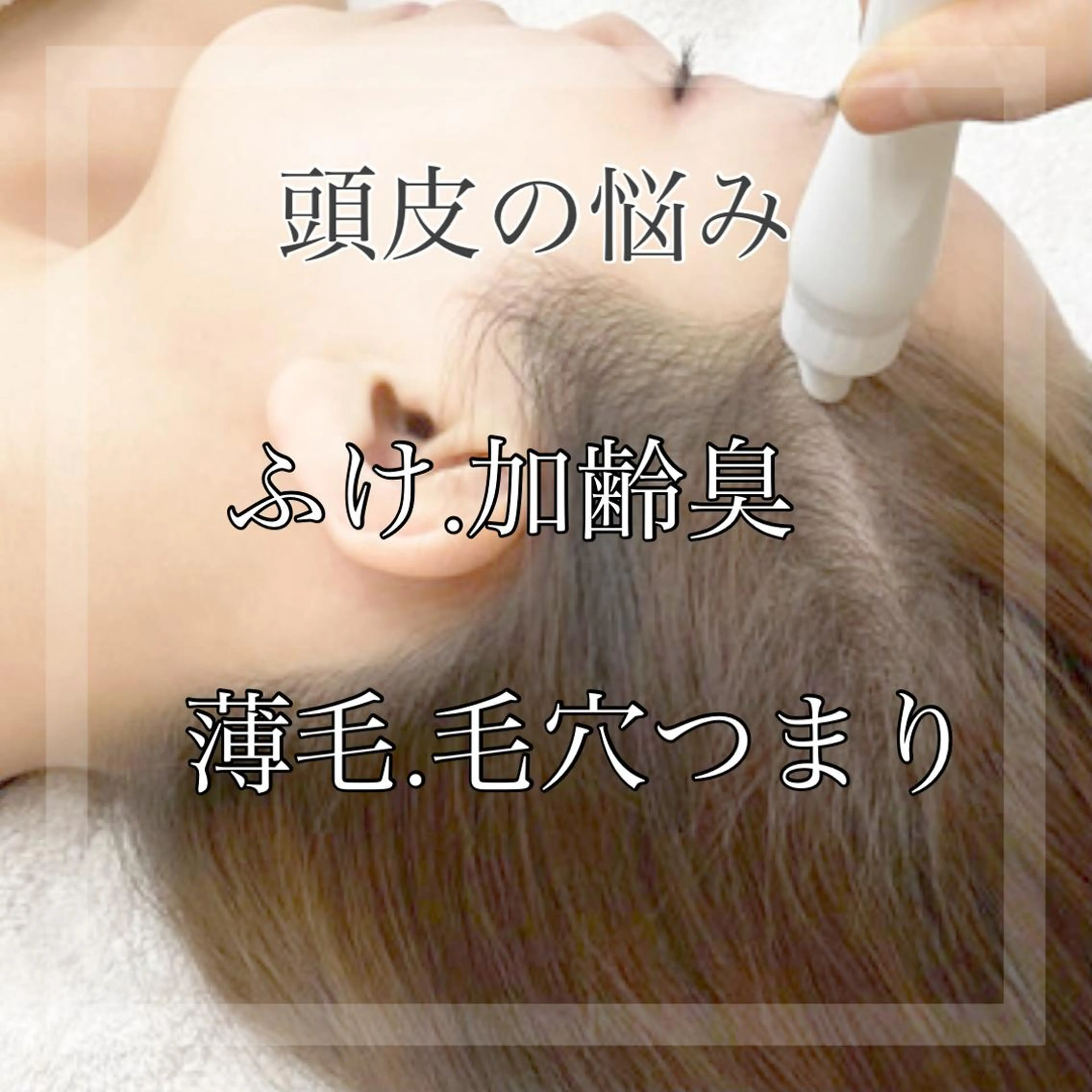 Chalon所属・REVI取扱・肌悩み 毛穴Chalonのエステ・リラクイメージ