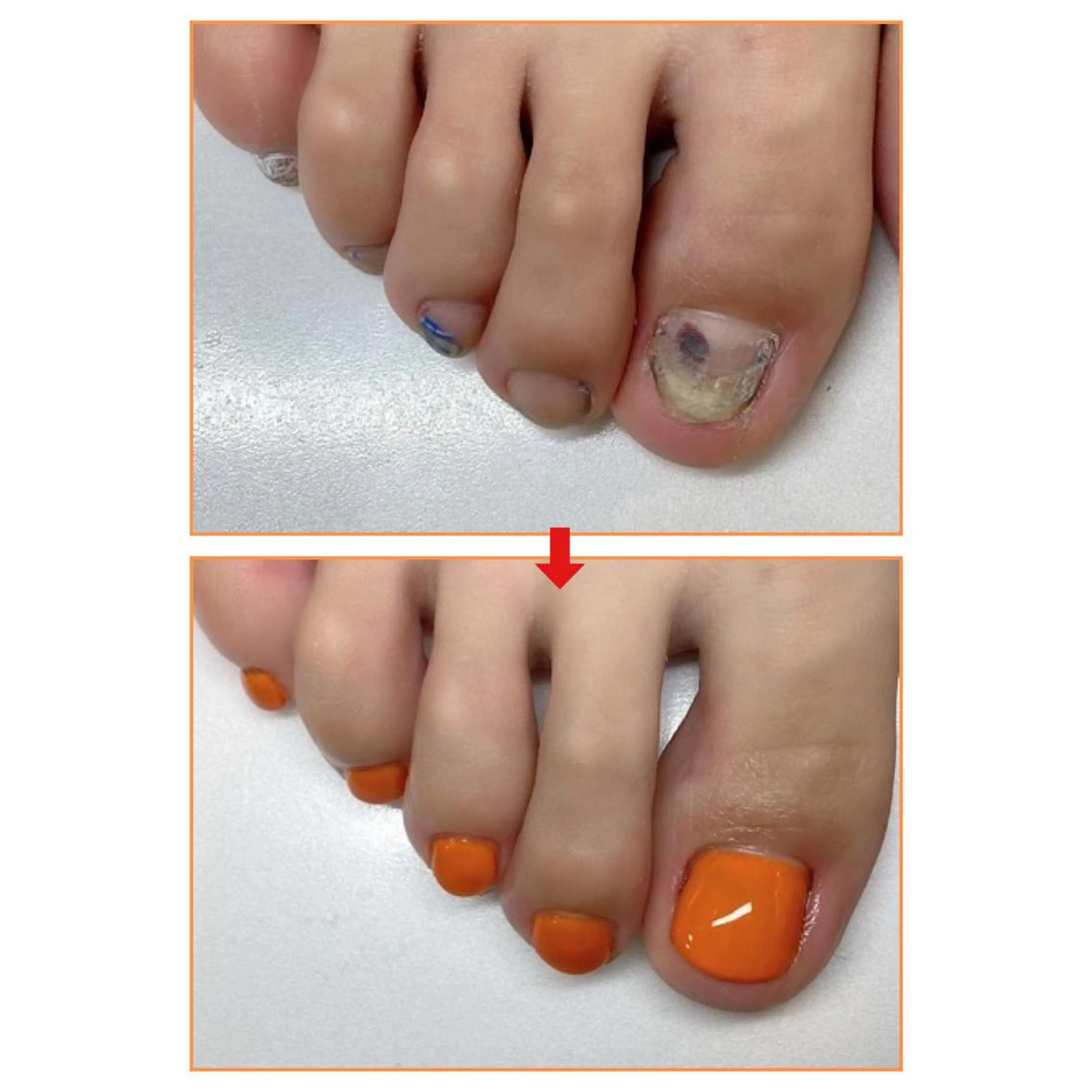 ネイル ネイルサロンアリューム所属・ネイルサロン アリュームのネイルデザイン